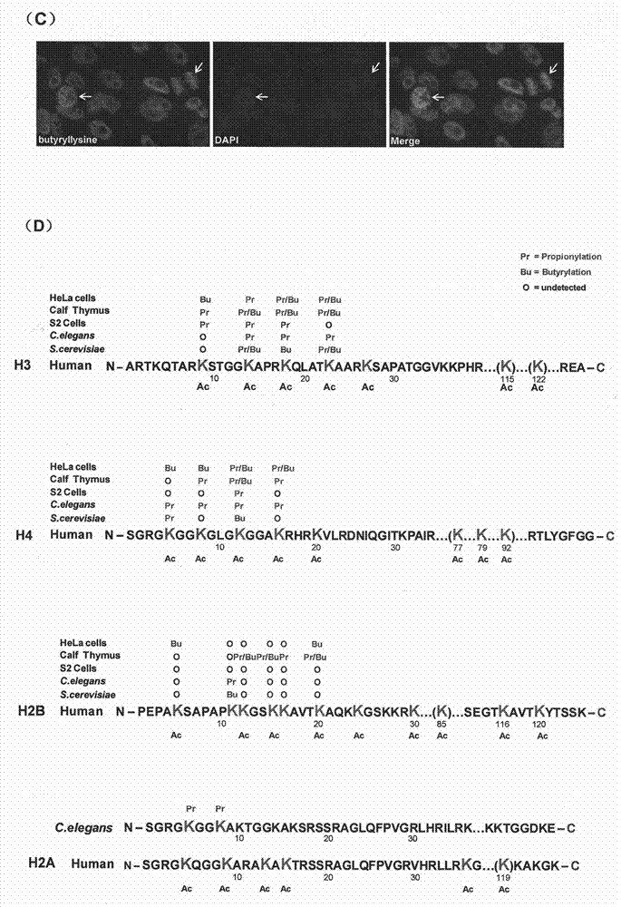 Method for screening and testing activity of lysine propionylation removal enzyme and butyrylation removal enzyme