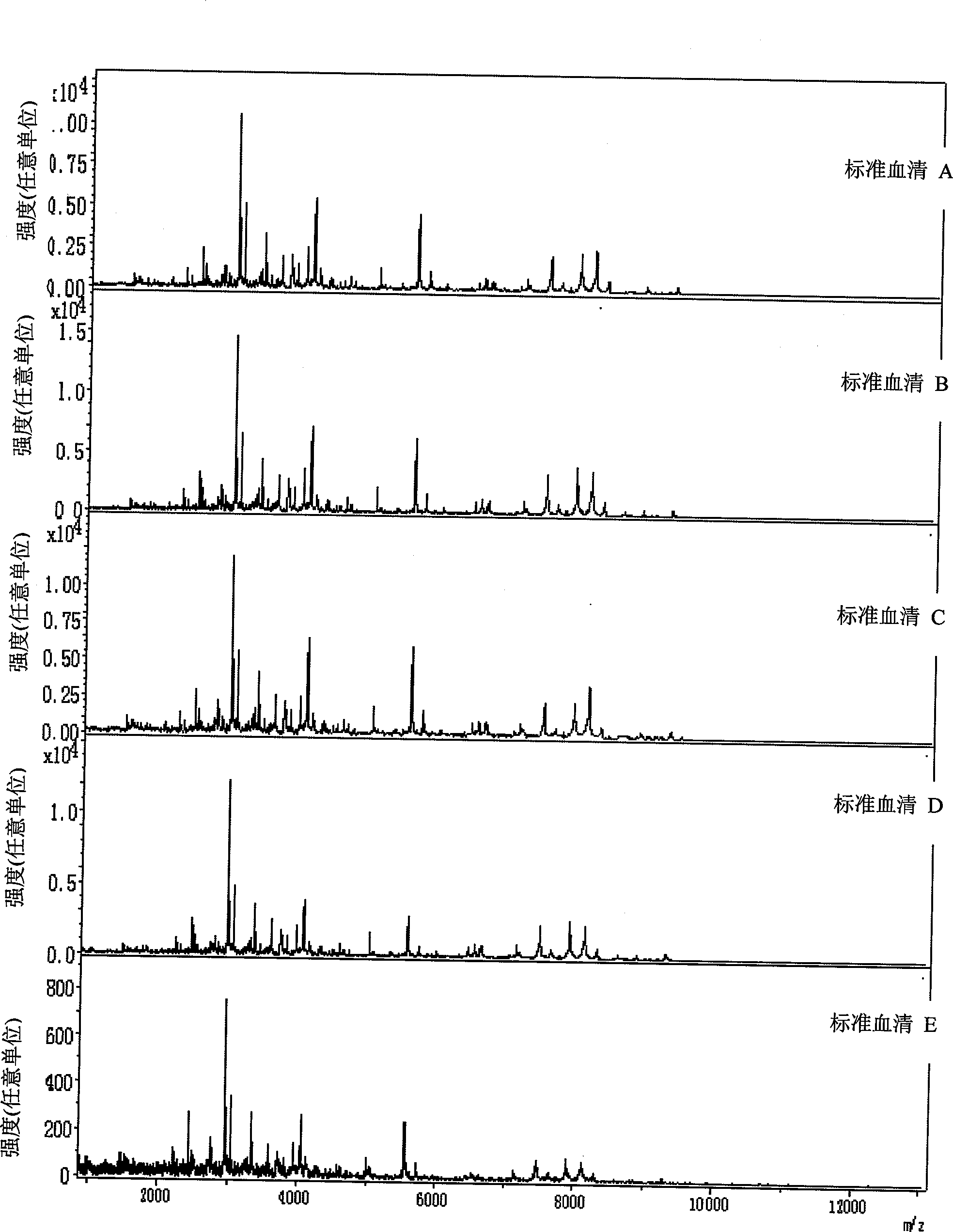 Mass spectrogram model for detecting brain glioma characteristic and preparing method thereof