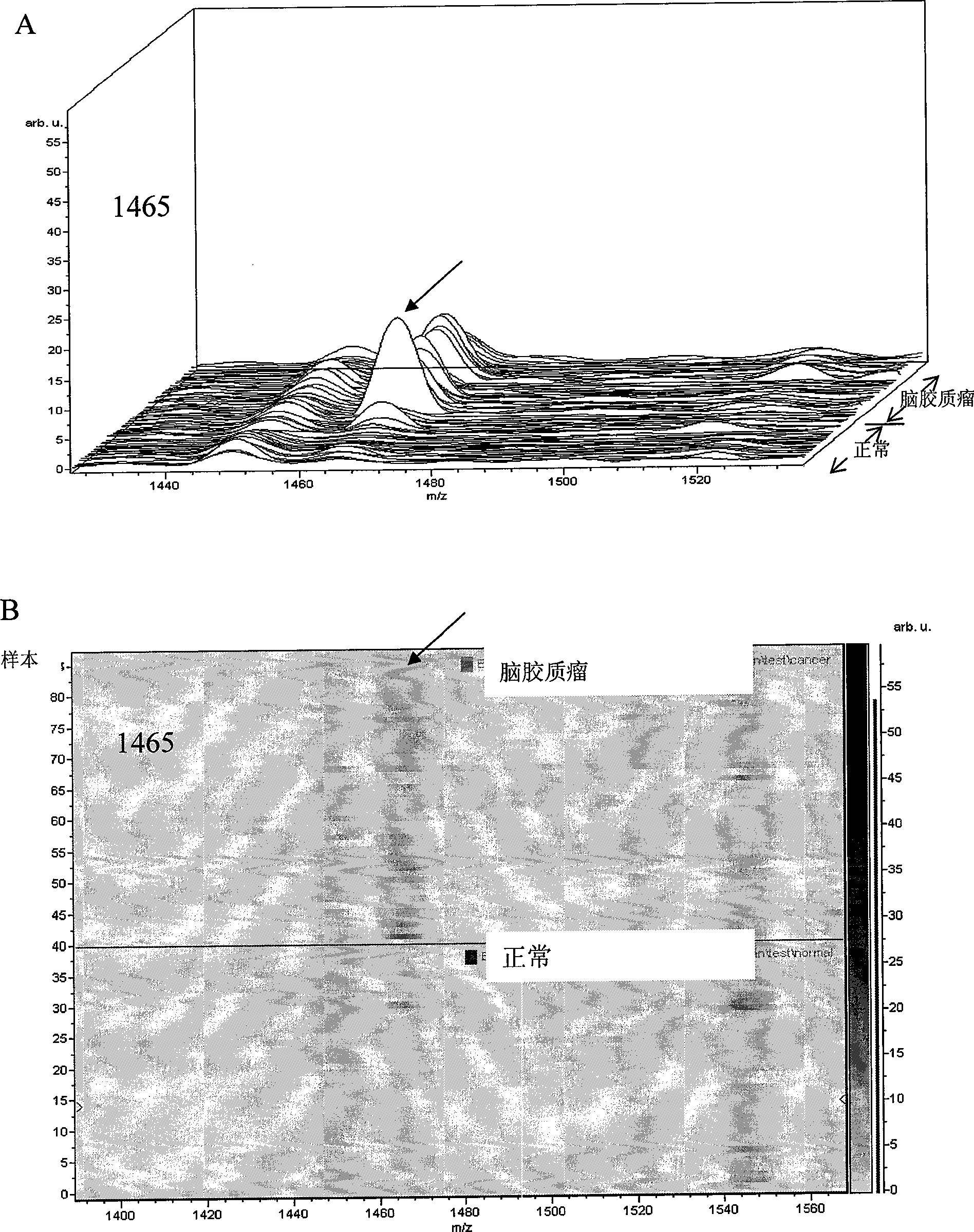 Mass spectrogram model for detecting brain glioma characteristic and preparing method thereof