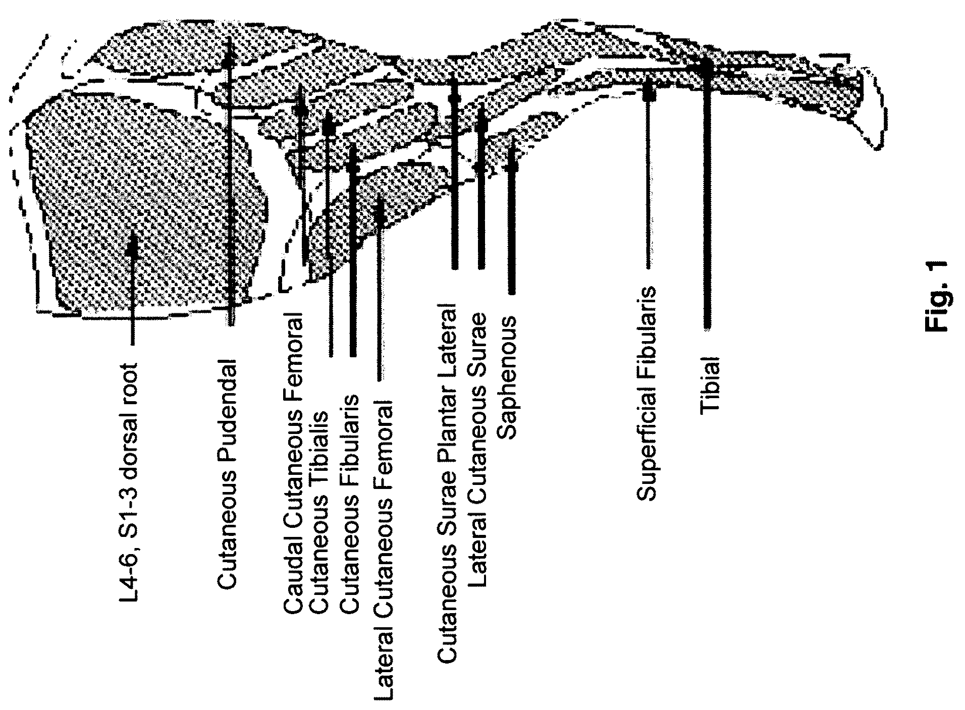 Model of experimentally induced chronic pain and uses thereof