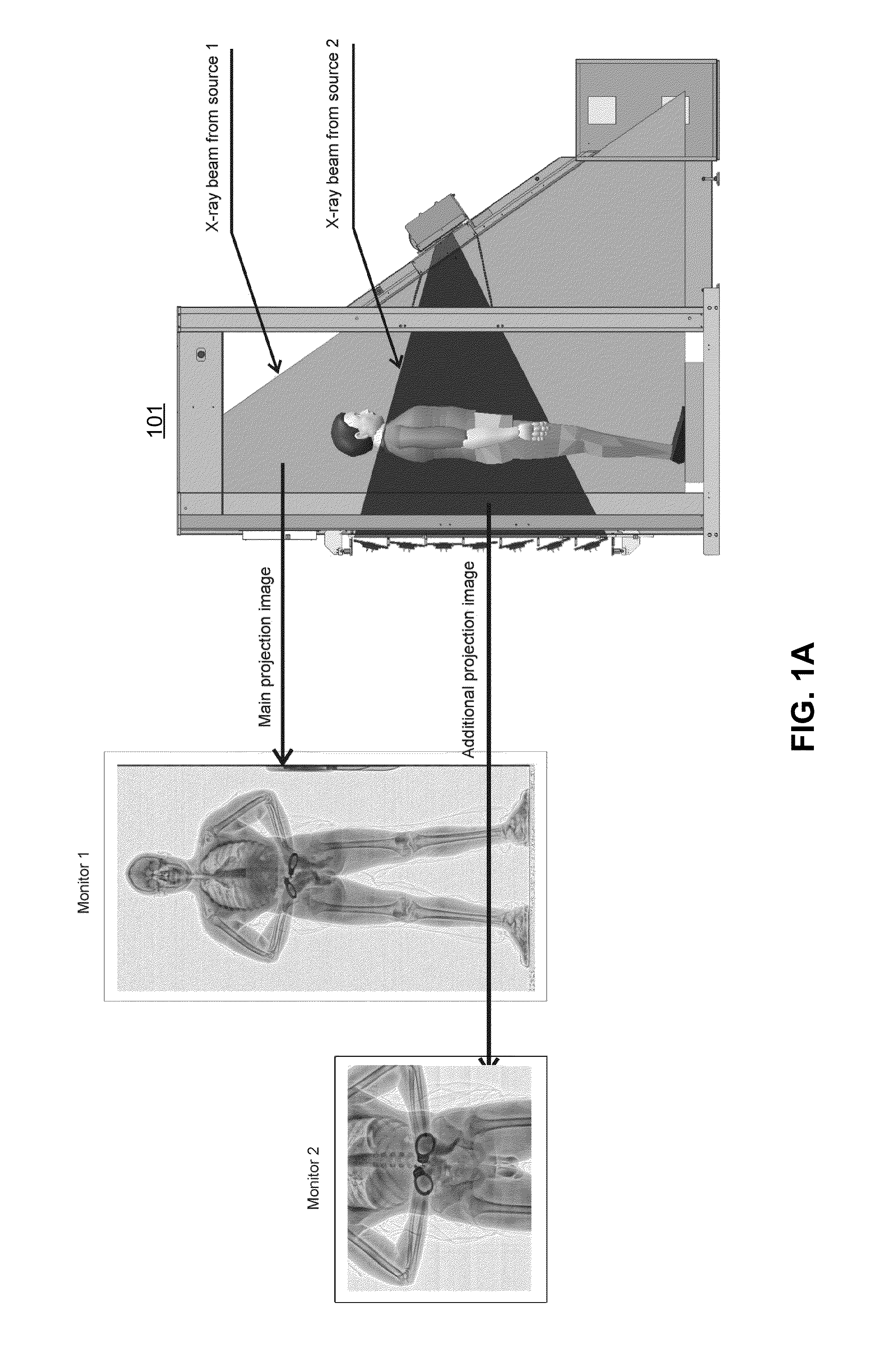 Multi-beam stereoscopic X-ray body scanner