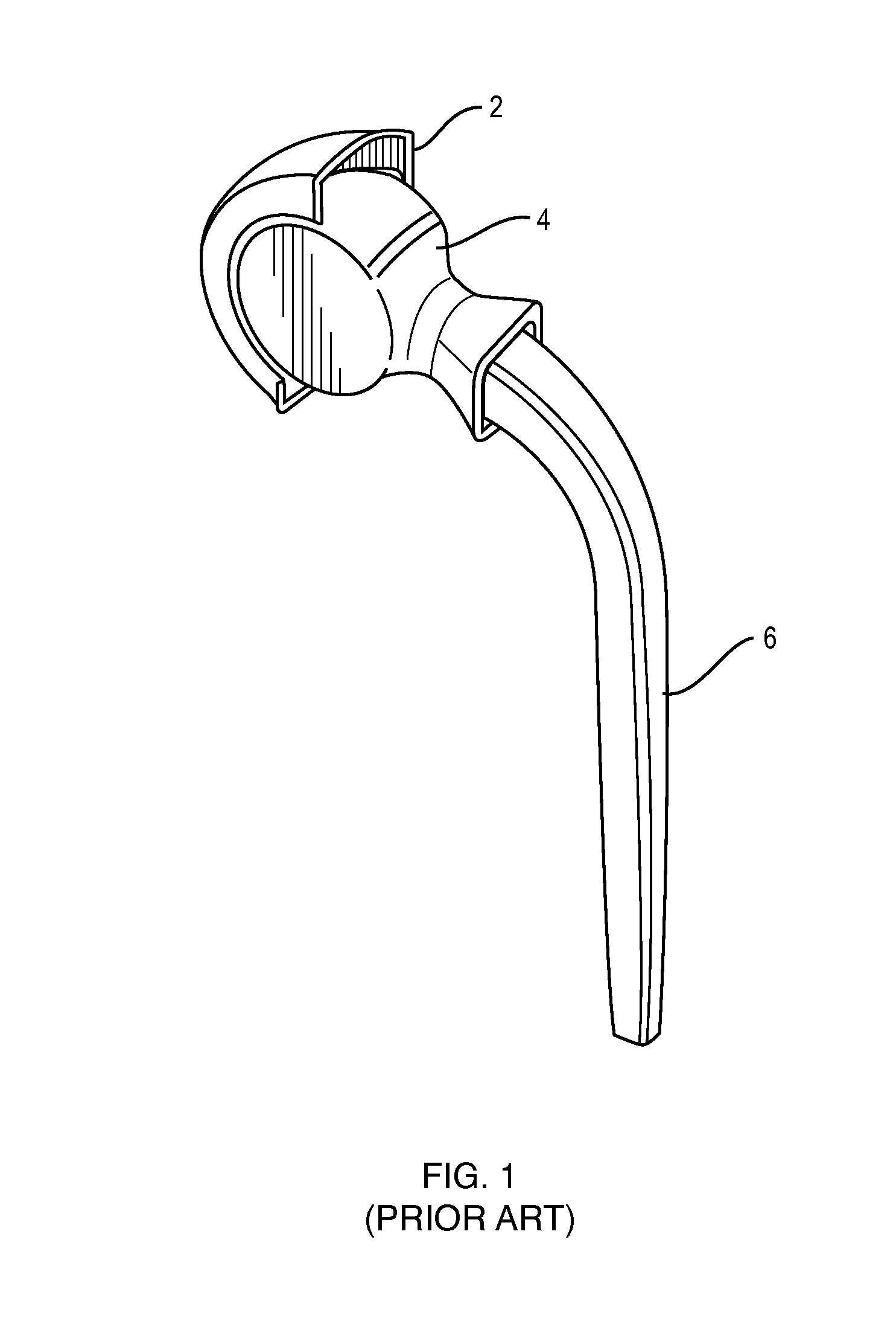 Extended life prosthetic hip joint