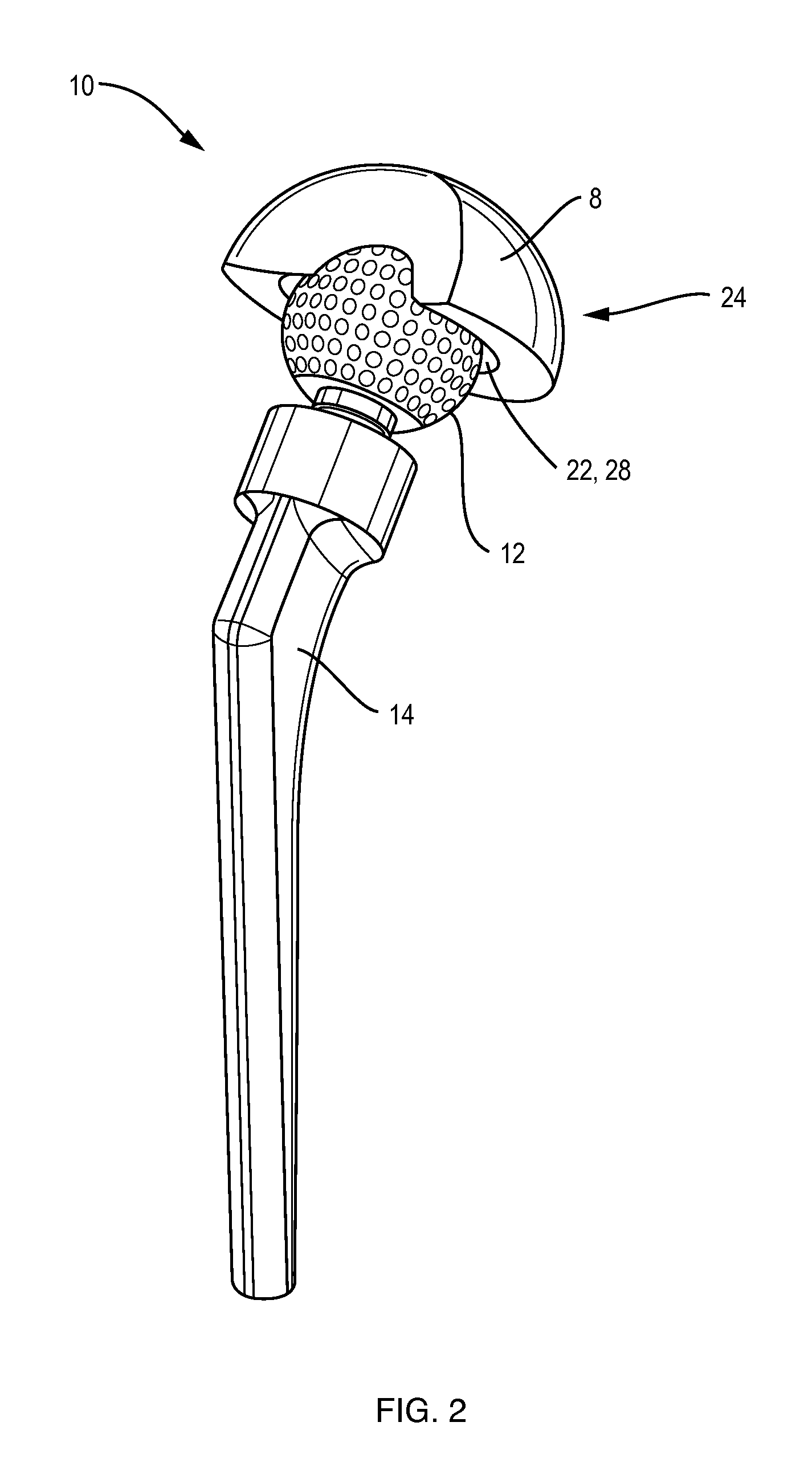 Extended life prosthetic hip joint