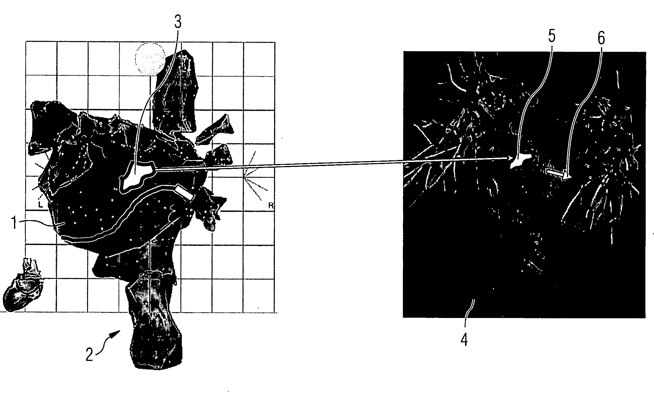 Method and apparatus for visually supporting an electrophysiological catheter application in the heart by means of bidirectional information transfer