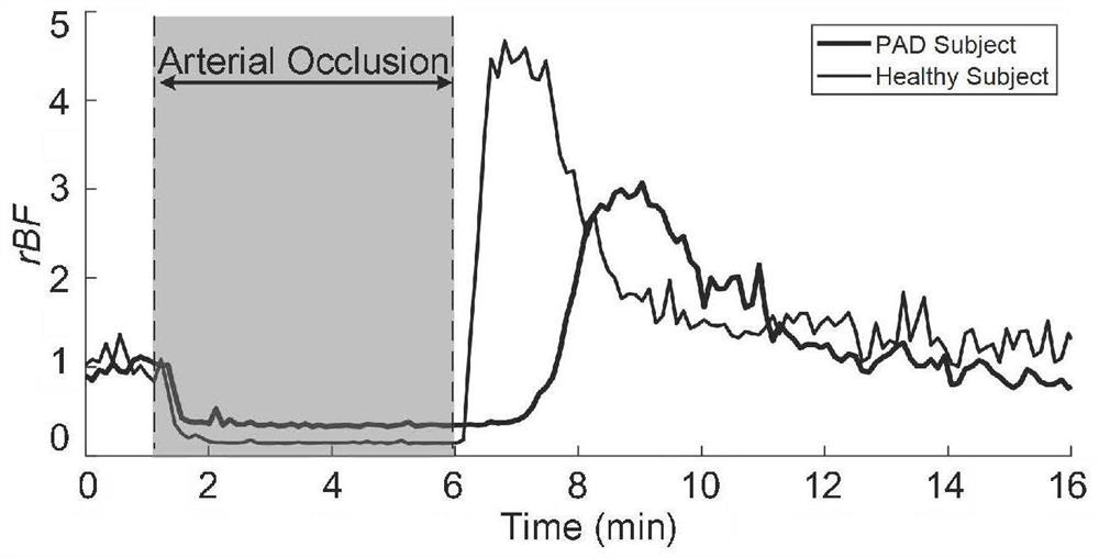 Peripheral arterial disease diagnosis method based on deep learning