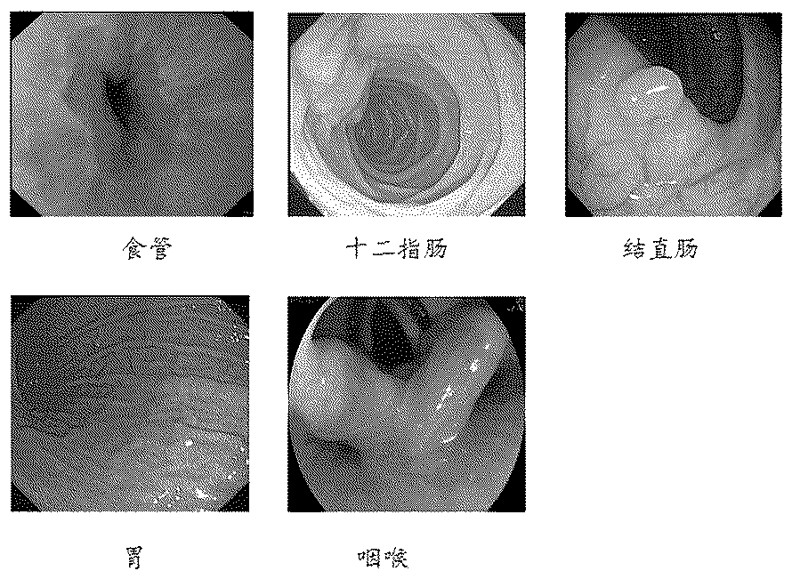 Method and device for training machine learning model based on endoscopic image, and storage medium