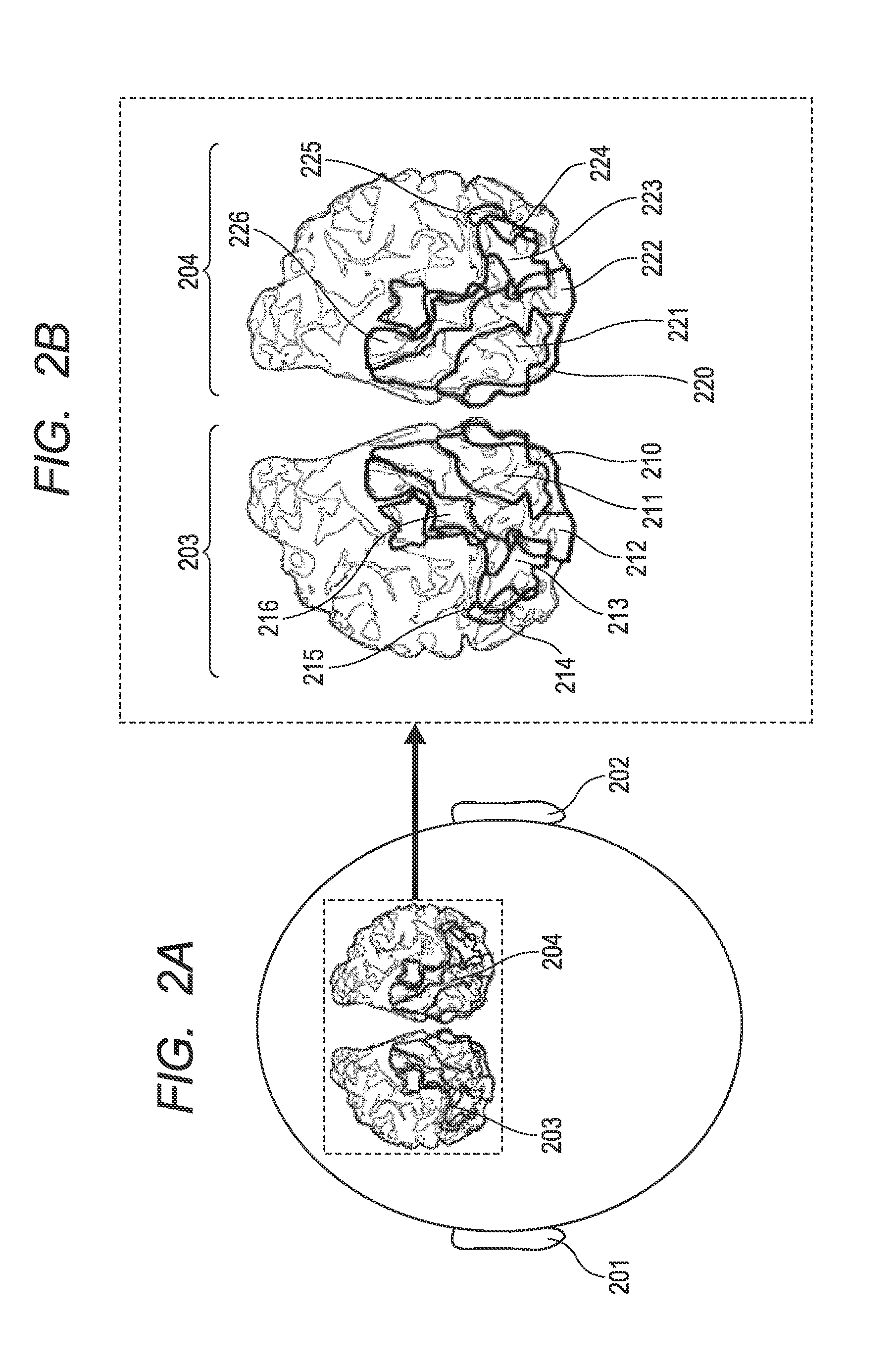 Method of identifying the spatial distribution of areas in a sensory area of brain, program, and recording medium therefor