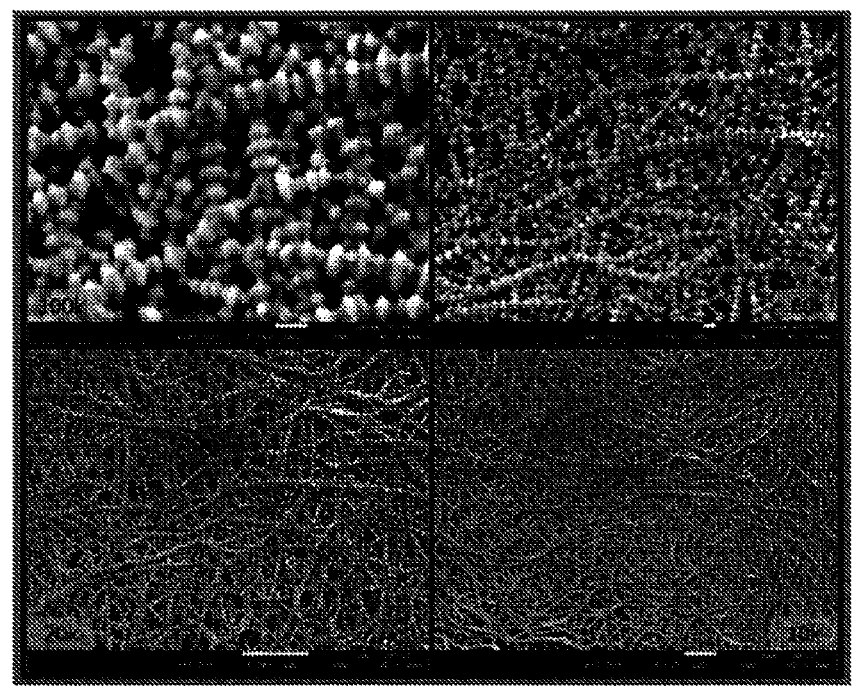 Nanoporous ultra-high molecular weight polyethylene membrane