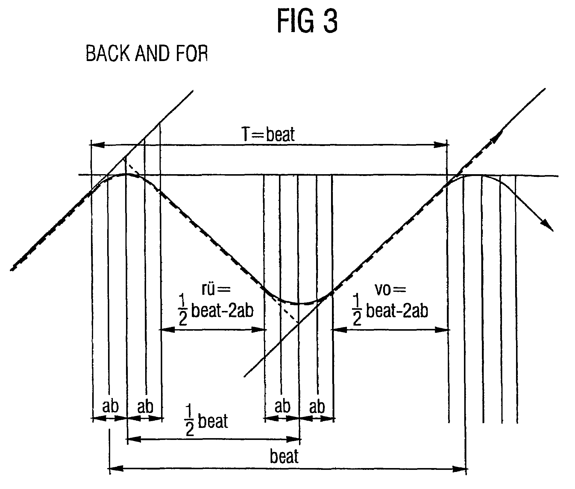 Automatic generation of musical scratching effects