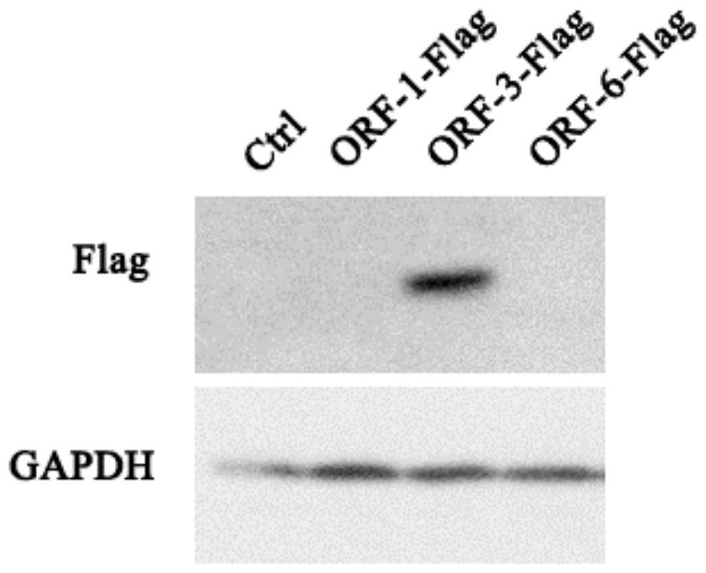 Small peptide capable of inhibiting metastasis of liver cancer and its preparation method and application