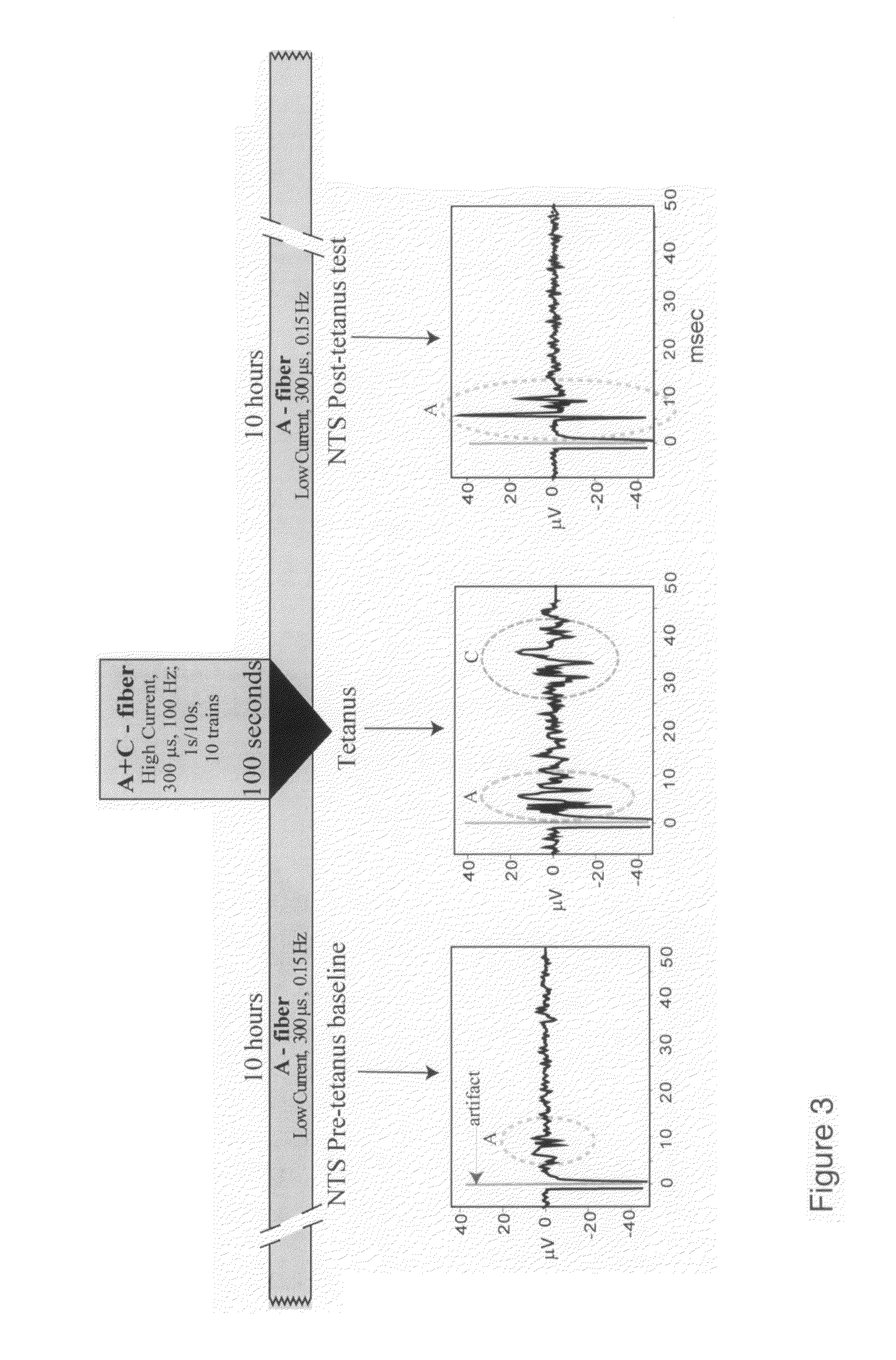 Homotopic conditioning of the brain stem baroreflex of a subject