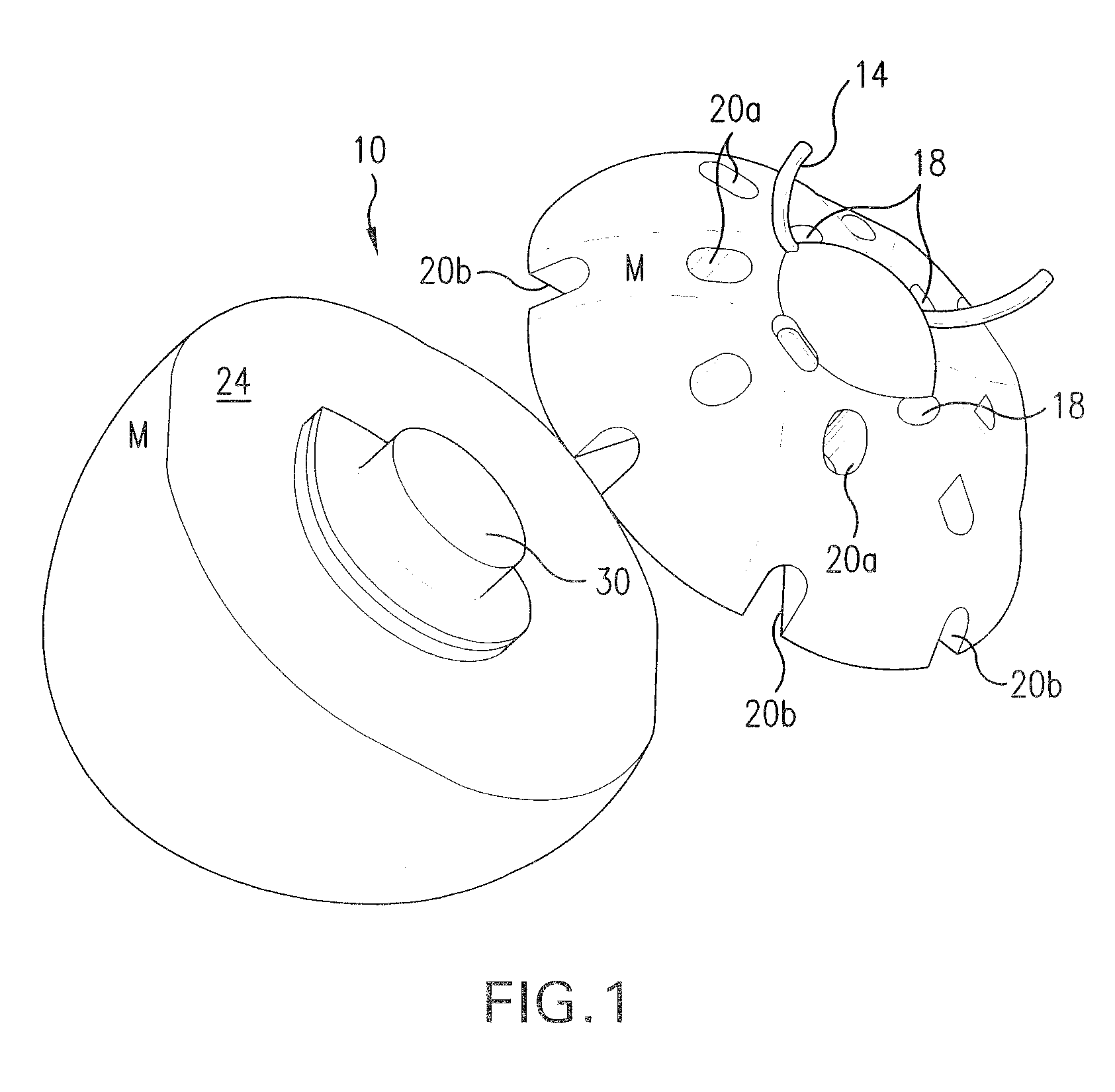 Quasi-spherical orbital implant