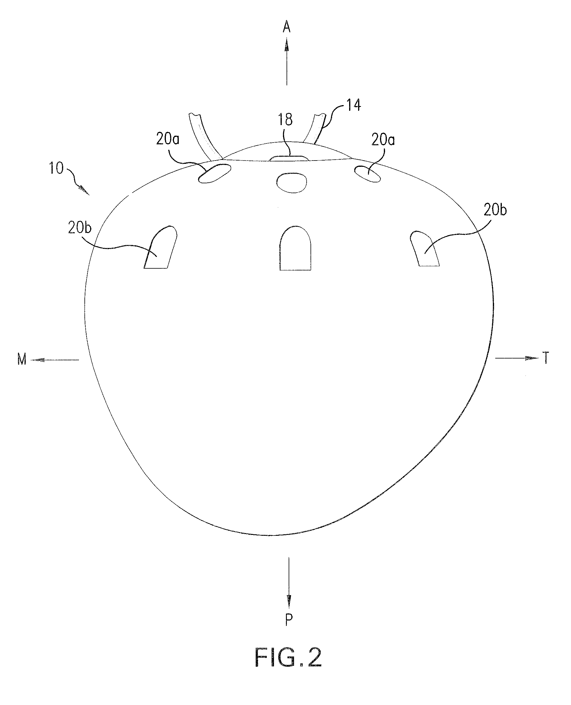 Quasi-spherical orbital implant