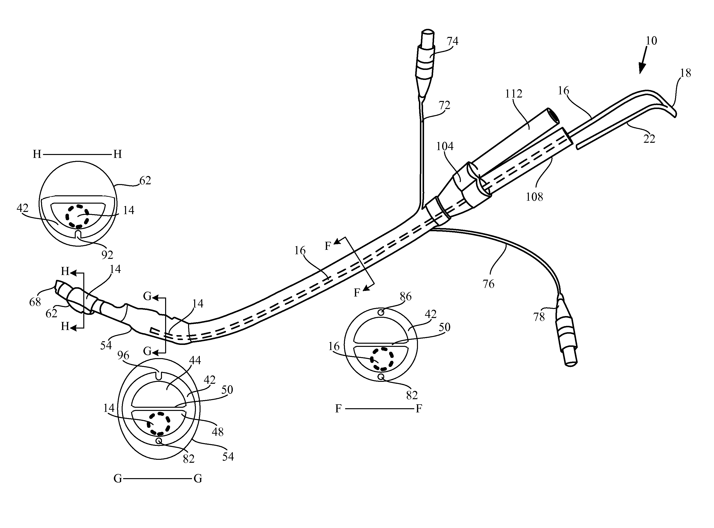 Semi-rigid stylet for advancement of double lumen endotracheal ventilating tubes