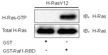 Method and kit for detecting Ras activity of small molecular G protein by utilizing GST pull-down and Western-Blot