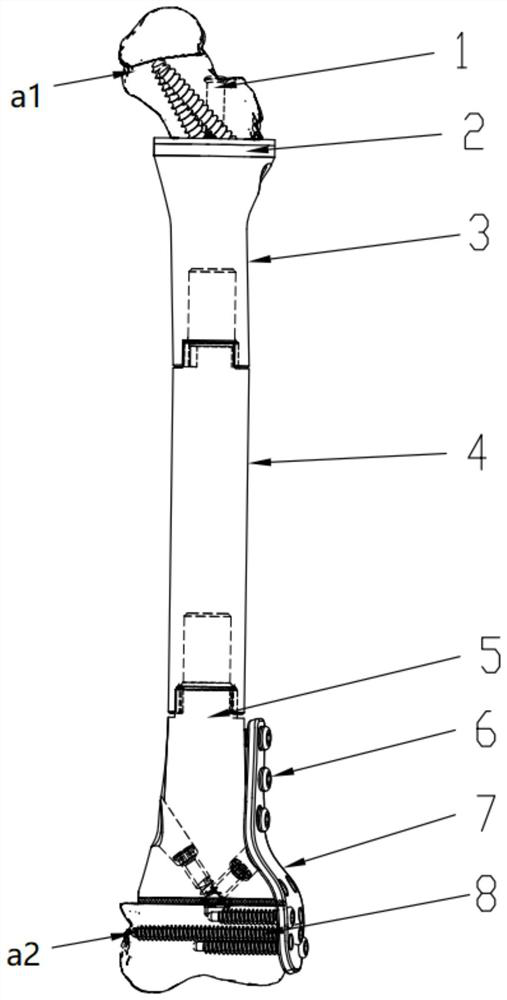 Children type tumor joint prosthesis reserving femur neck and knee joint surface