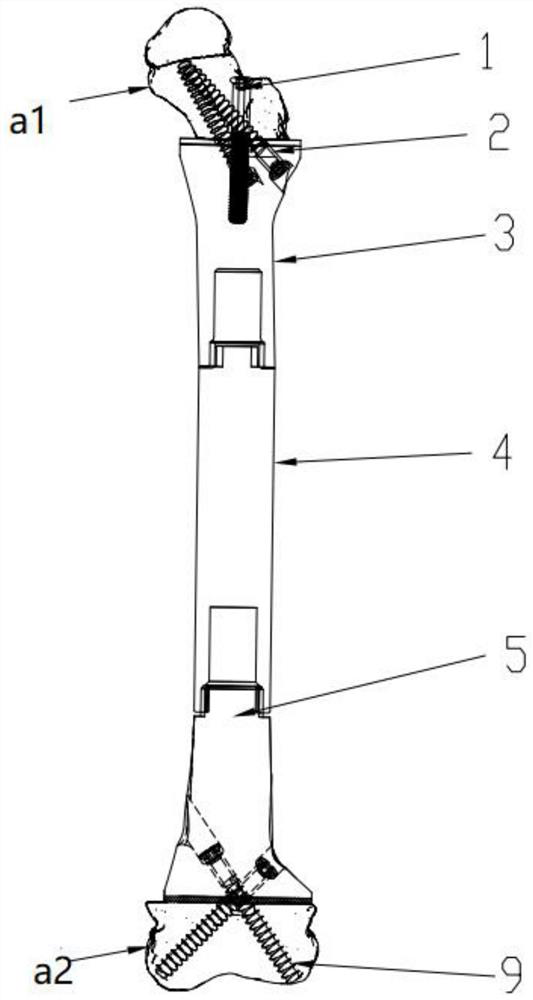 Children type tumor joint prosthesis reserving femur neck and knee joint surface