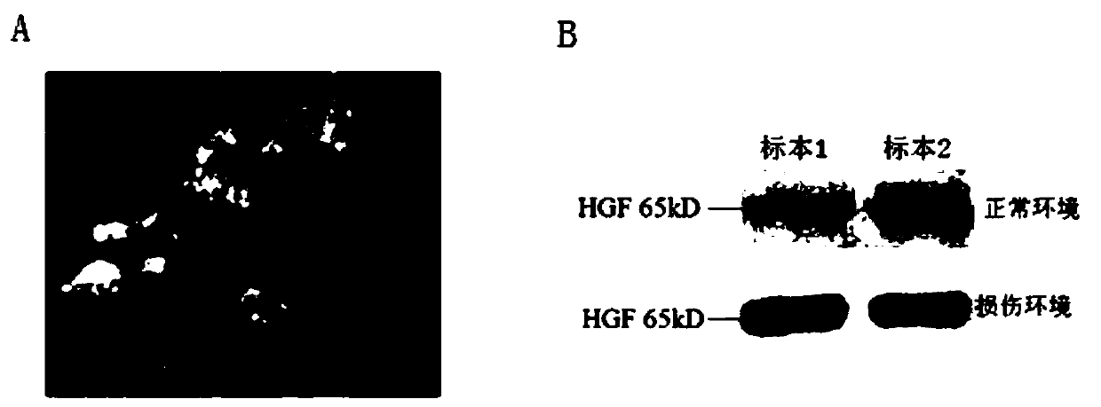 Immune tolerance agent