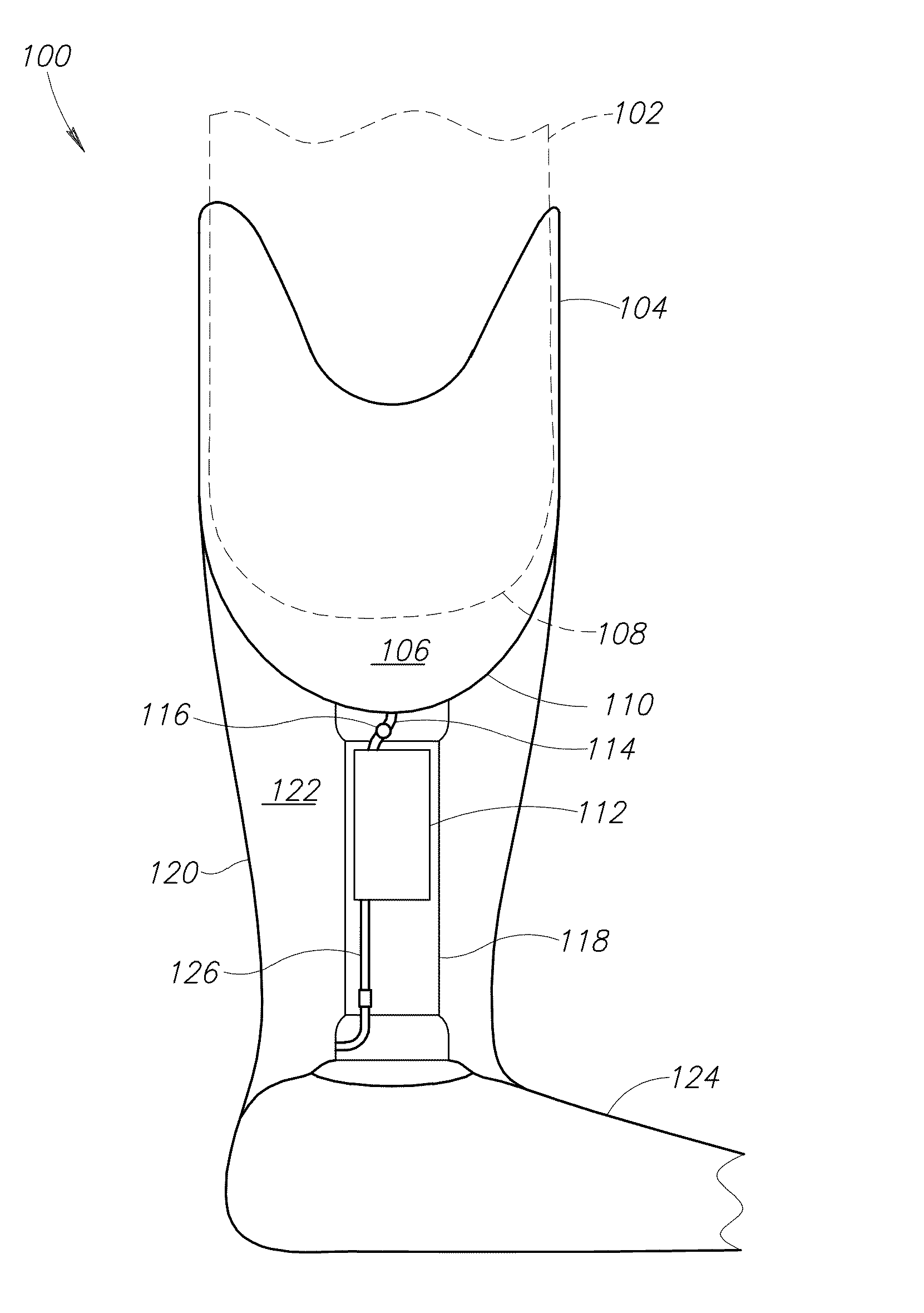 Pump system for prosthesis