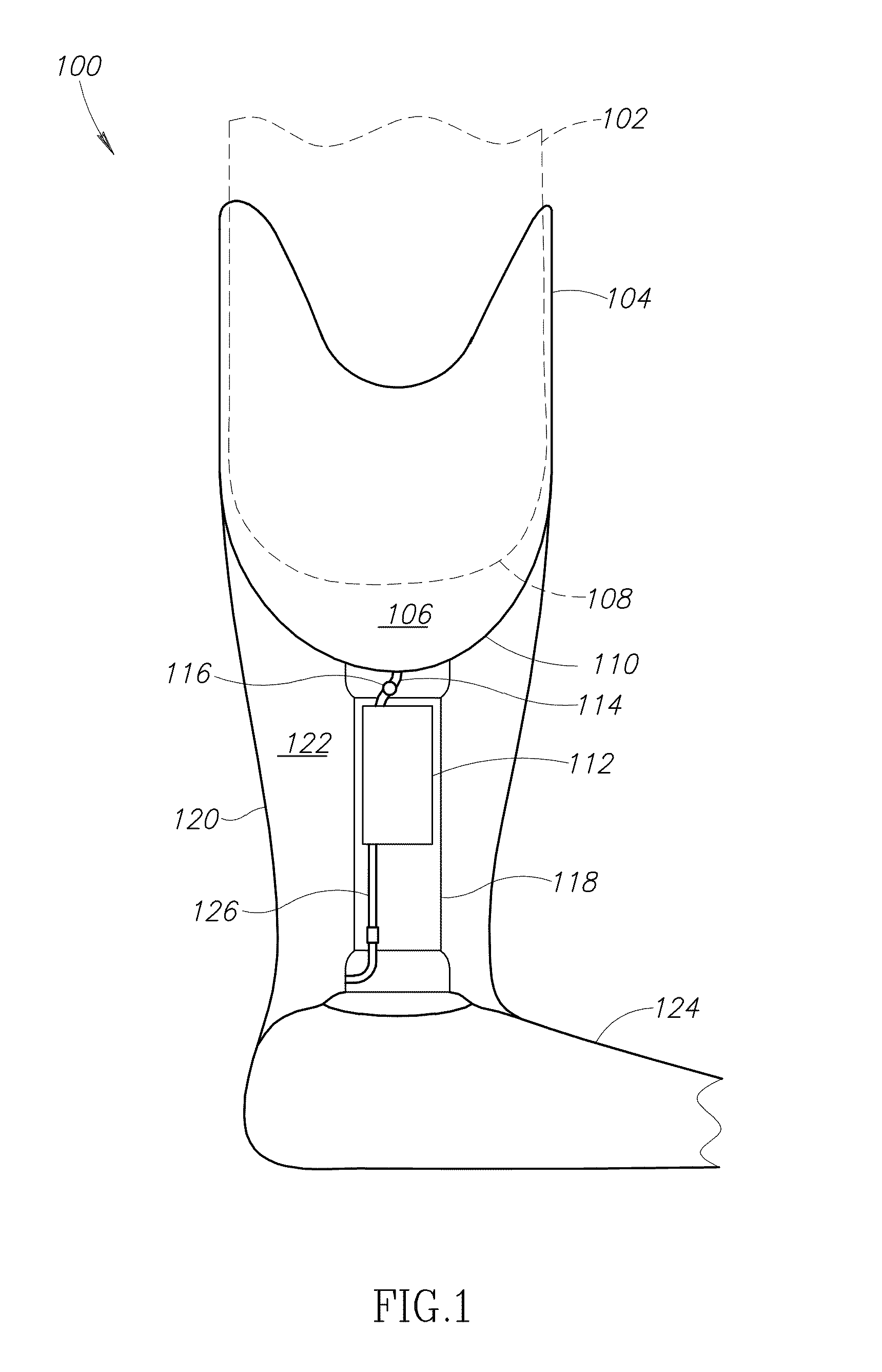 Pump system for prosthesis