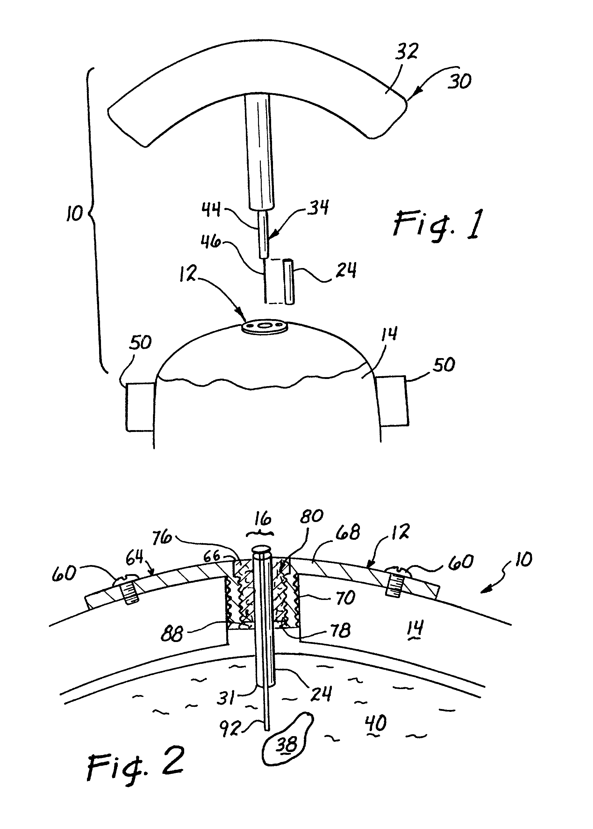 Non-scatterable, radio-opaque material for medical imaging applications