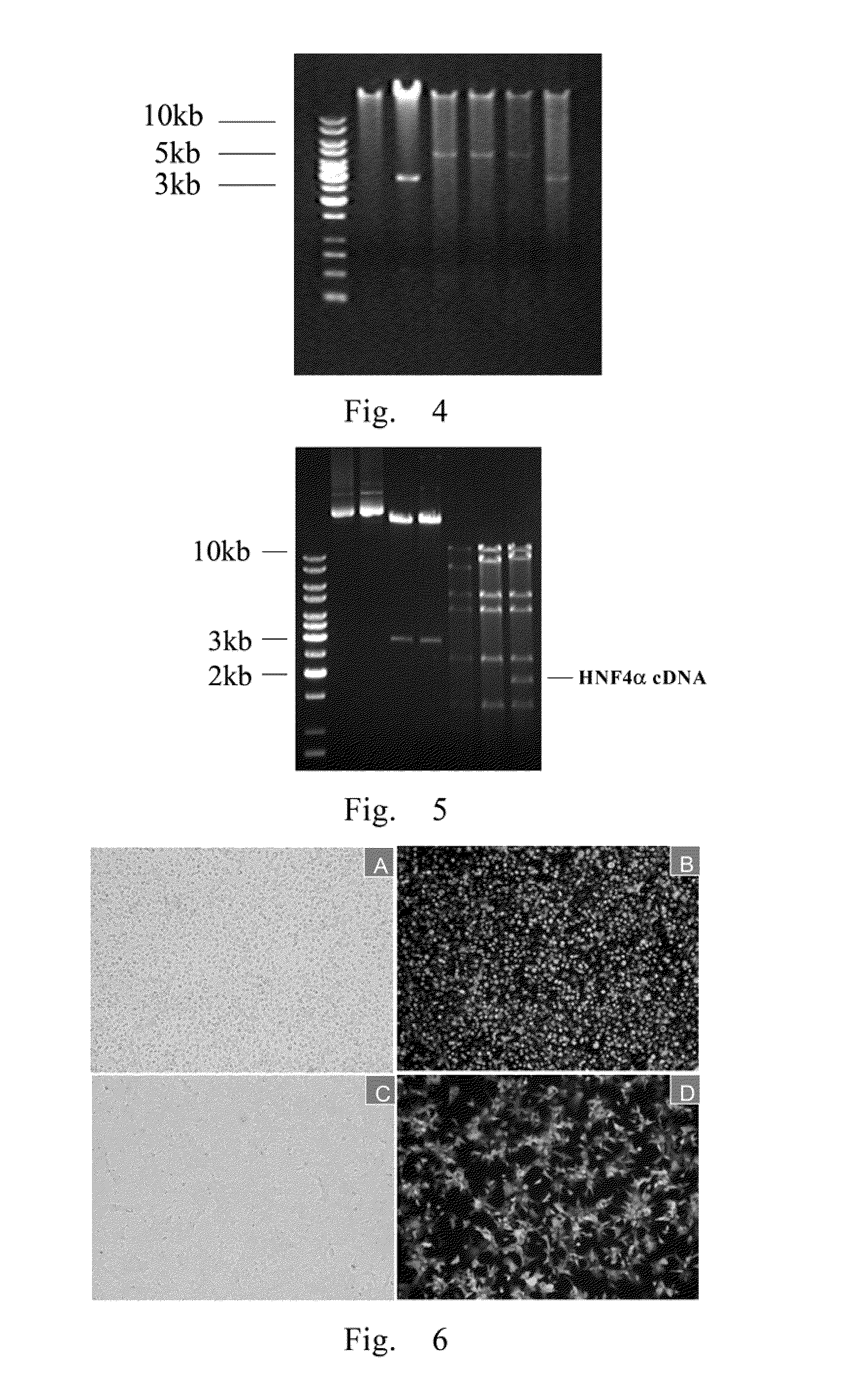 Use of hnf4alpha for treatment of human malignant solid tumors through induction-differentiation therapy