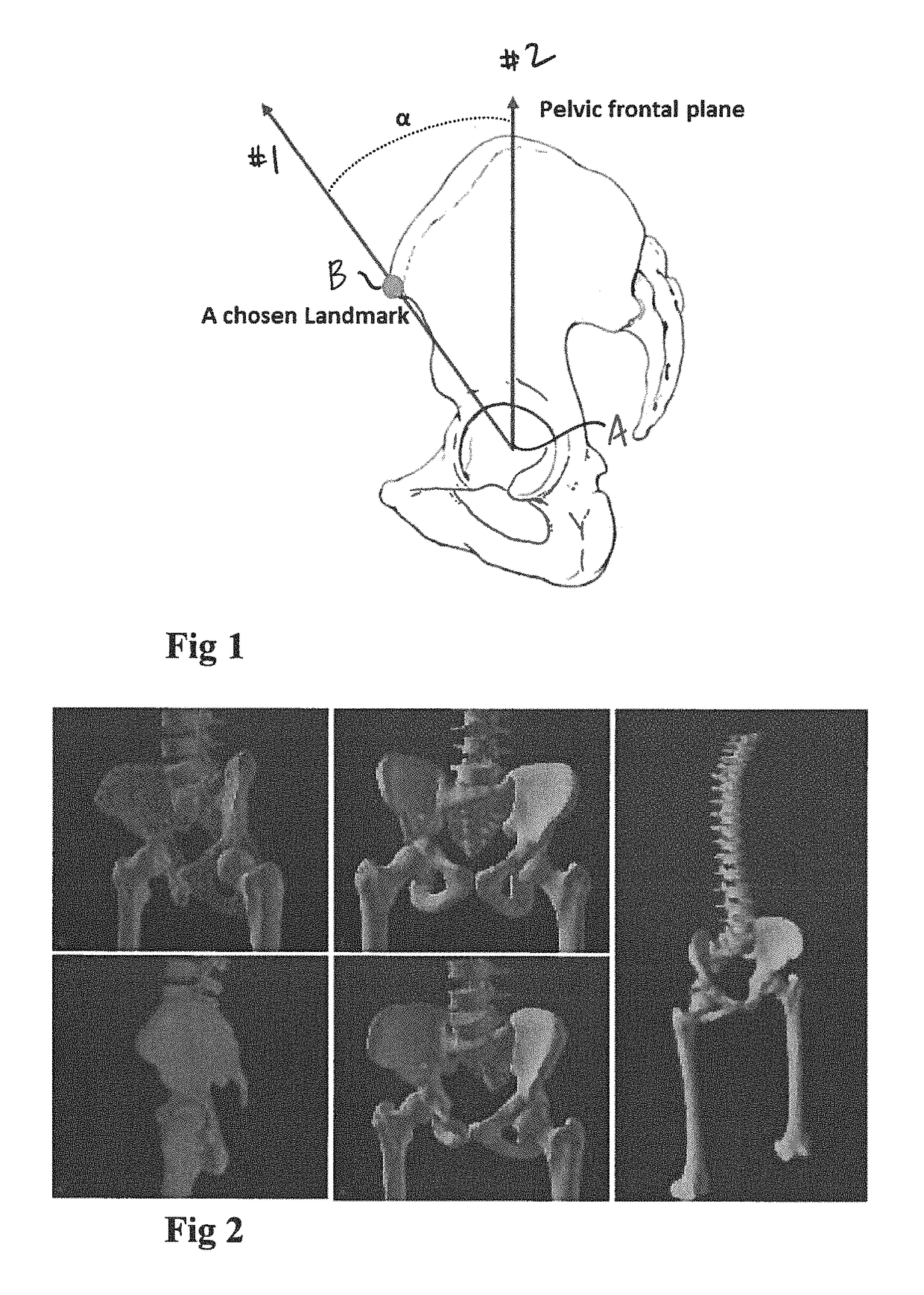 Acetabular cup prosthesis positioning instrument and method