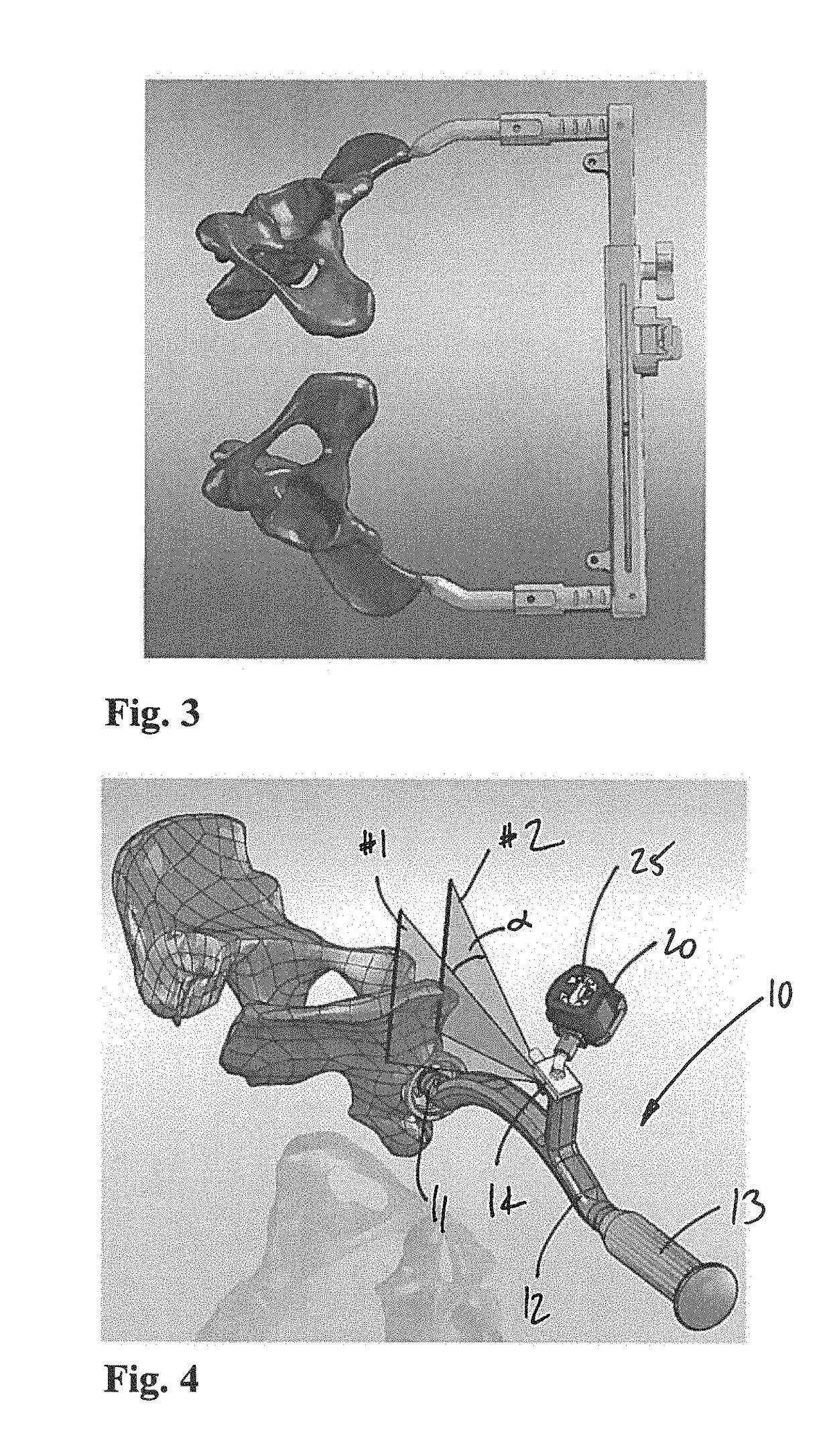 Acetabular cup prosthesis positioning instrument and method