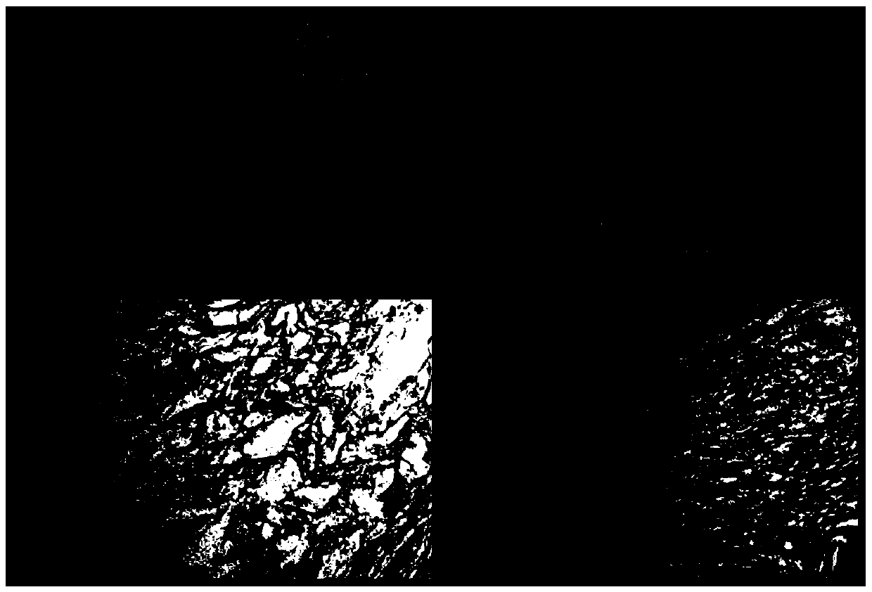 Human colon cancer extracellular matrix in-vitro model and preparation method thereof