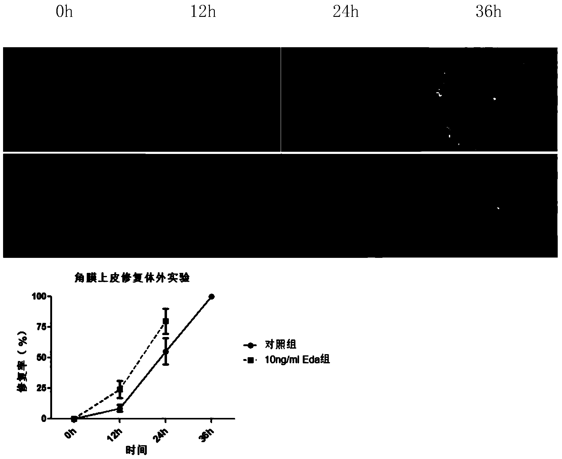 Ectodysplasin (Eda)-containing medicine for treating ocular surface diseases and corneal diseases