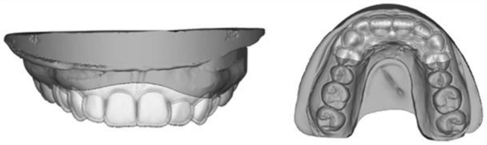 Production method of gingiva forming and alveolar bone trimming surgery guiding device and guiding device