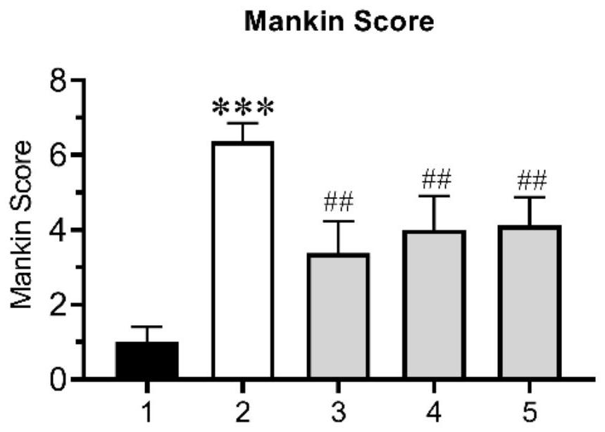 Mesenchymal stem cell exosome as well as preparation method and application thereof