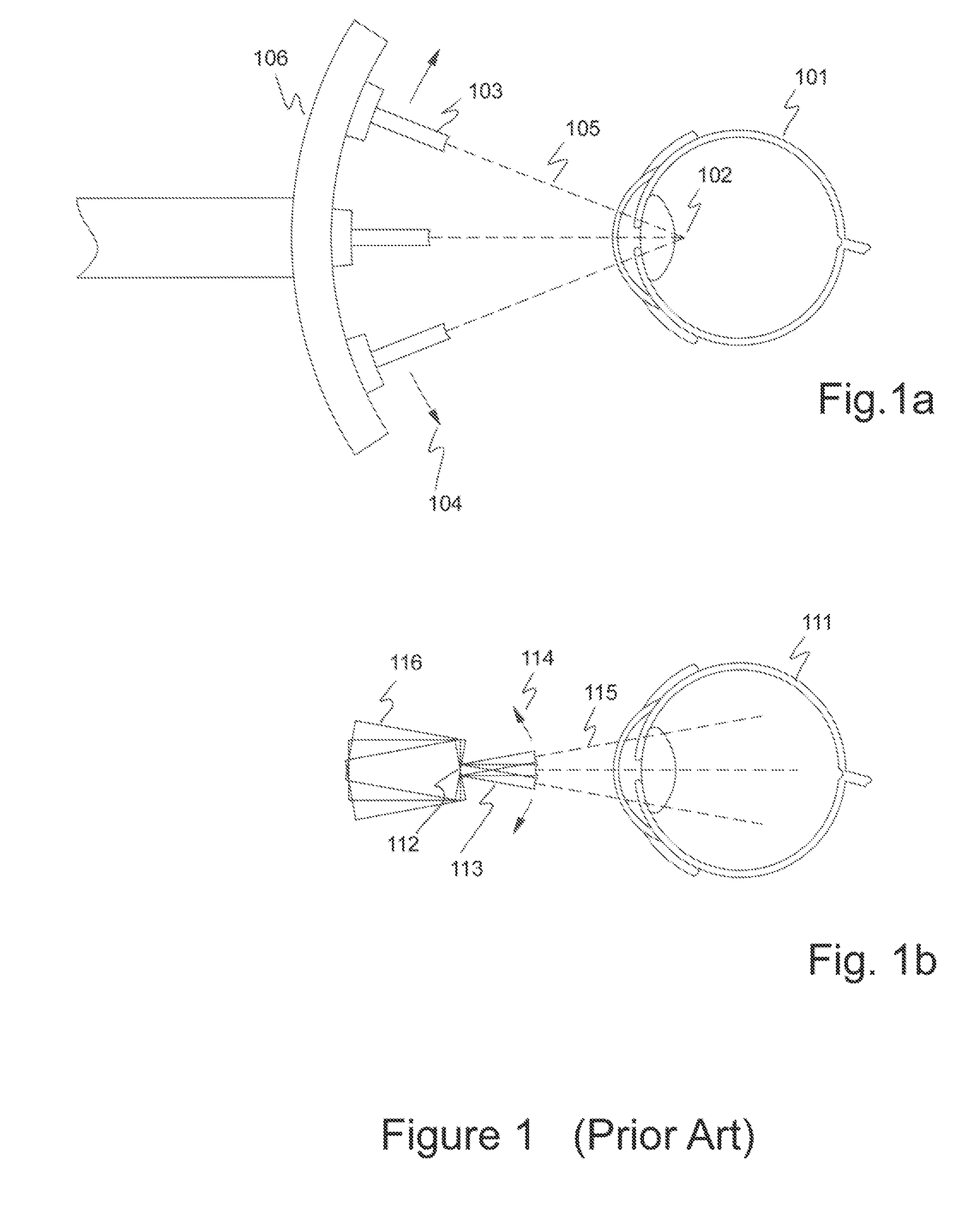 Disposable eyepiece system for an ultrasonic eye scanning