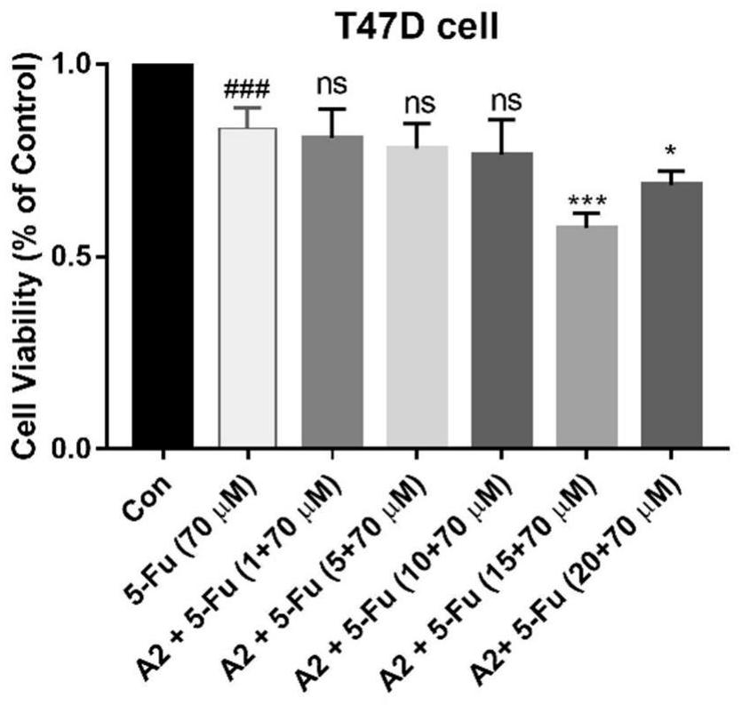 Application of hematoporphyrin derivative combined with chemical drug in breast cancer treatment