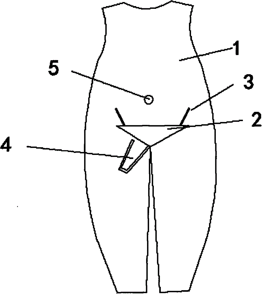 Garment with catheter and good waterproofness and air permeability