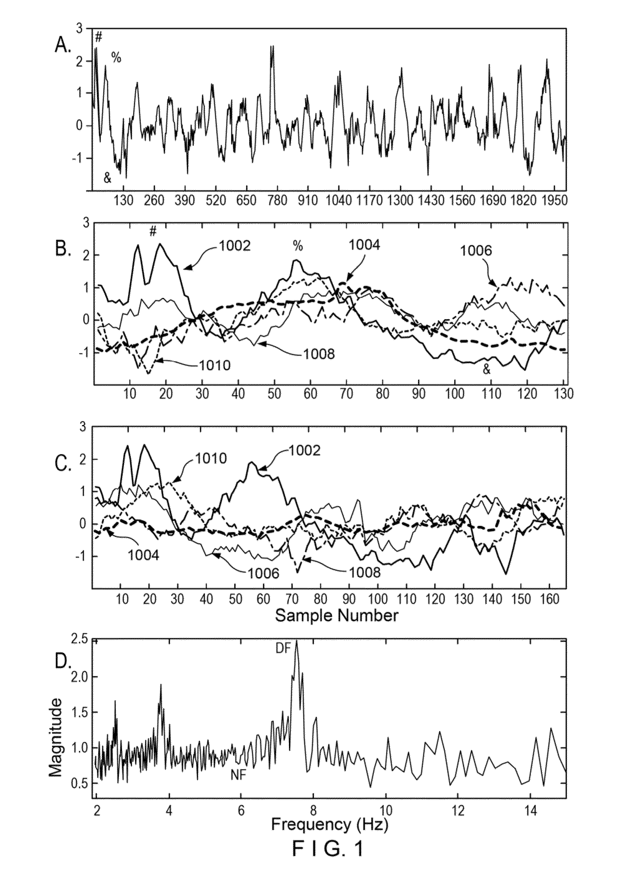 Apparatus, method, and computer-accessible medium for transform analysis of biomedical data