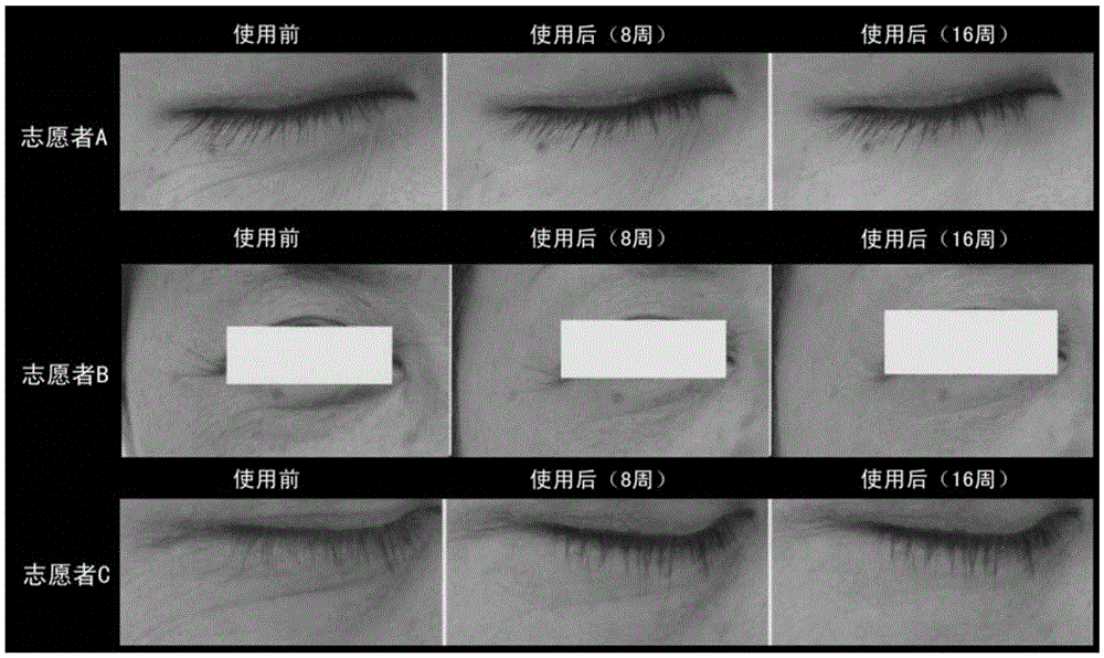 Cosmetic composition containing pistachio and hedera helix extracts