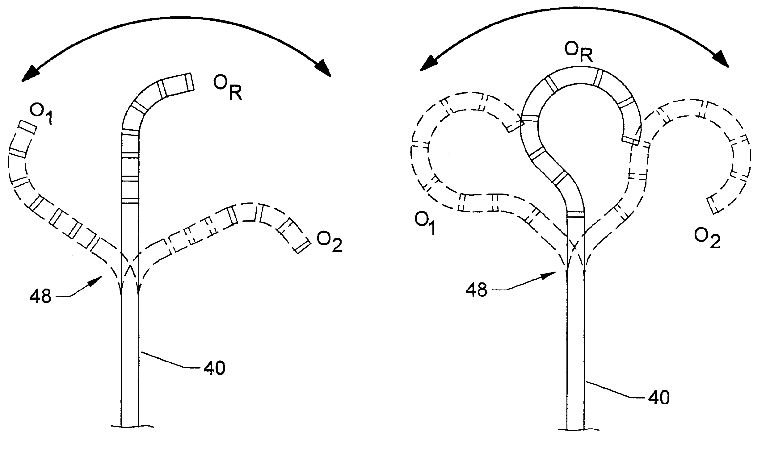 Pre-shaped catheter with proximal articulation and pre-formed distal end