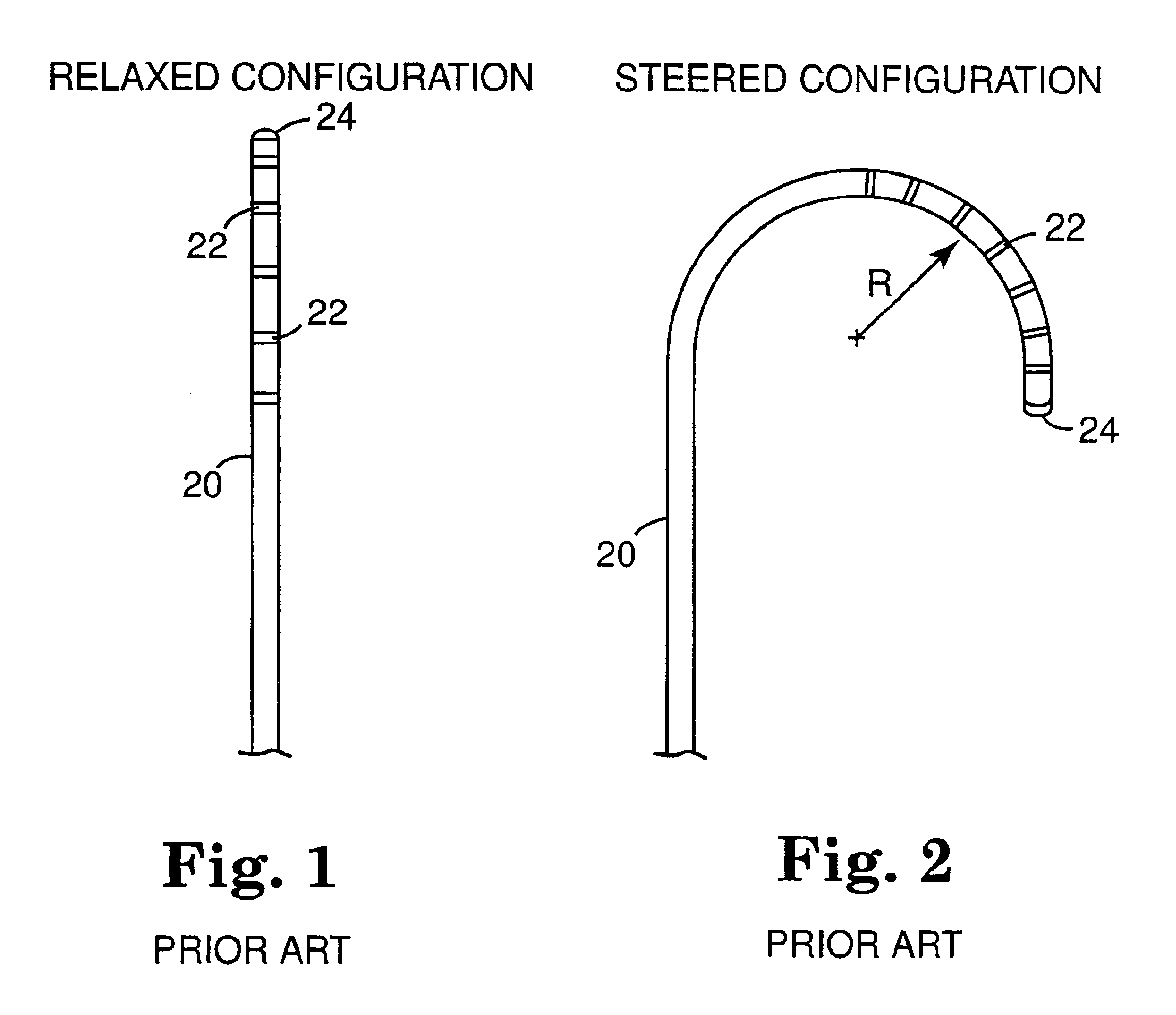 Pre-shaped catheter with proximal articulation and pre-formed distal end