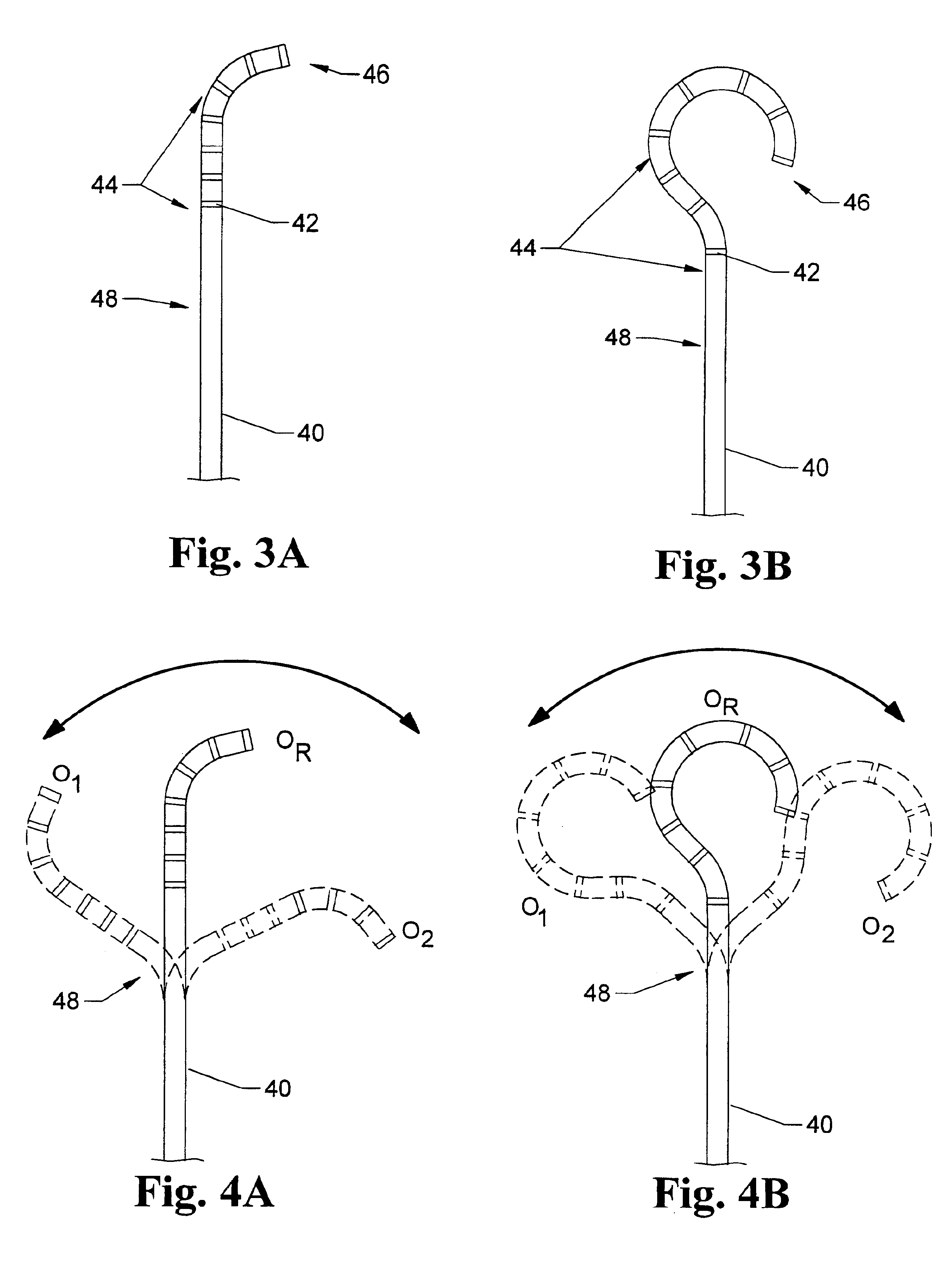 Pre-shaped catheter with proximal articulation and pre-formed distal end