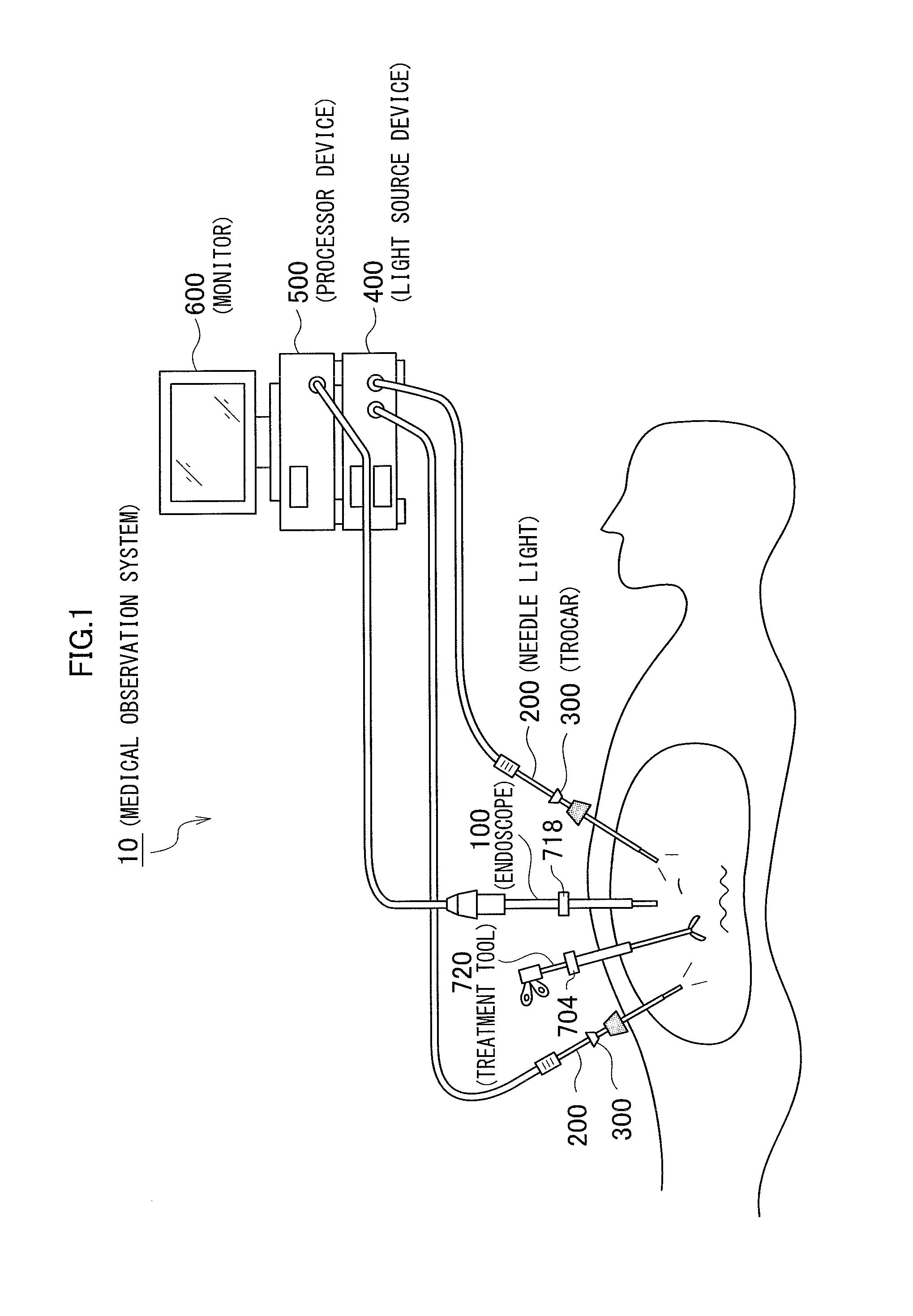 Method of placing medical insertion instruments in body cavity