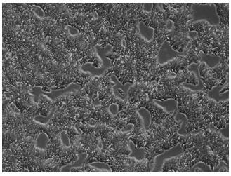 A method for directed differentiation of autologous immune cells into islet cells