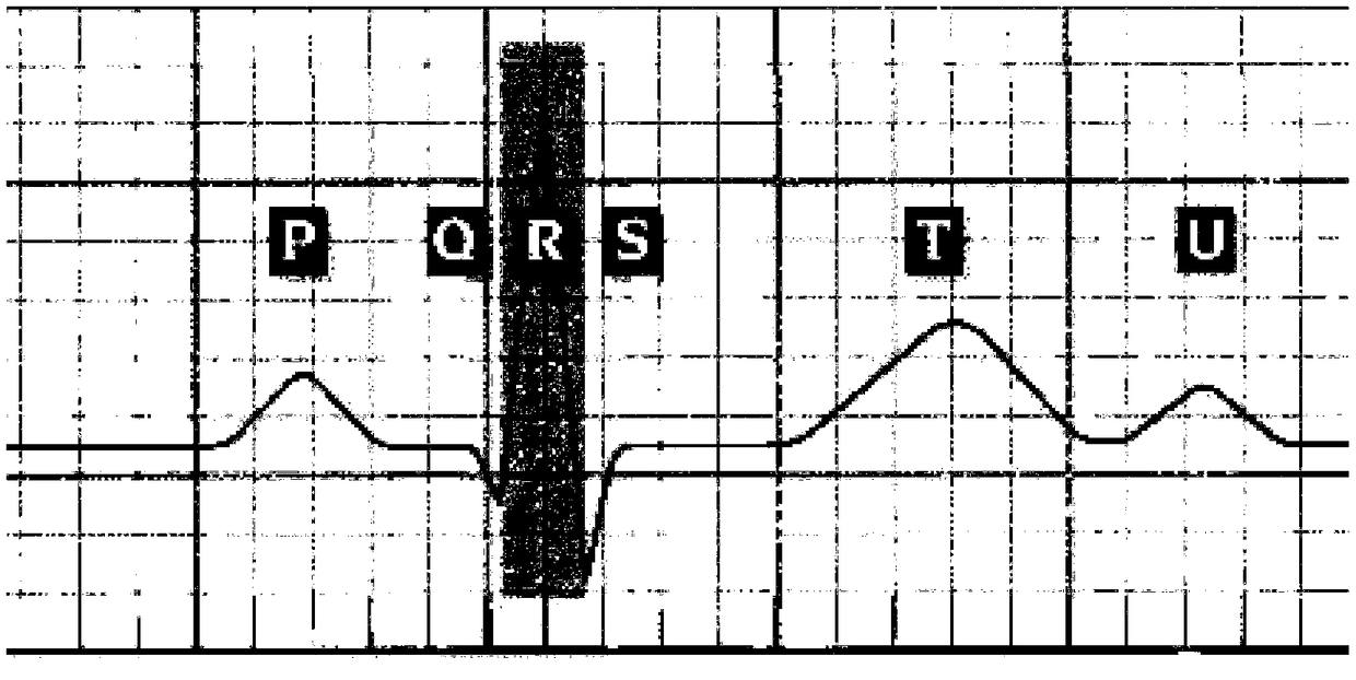 Atrial fibrillation detection device and storage medium