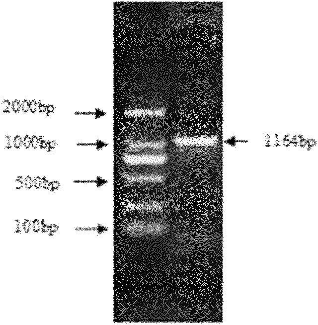 Riemerella anatipestifer-escherichia coli outer membrane protein bivalent vaccine and preparation method thereof