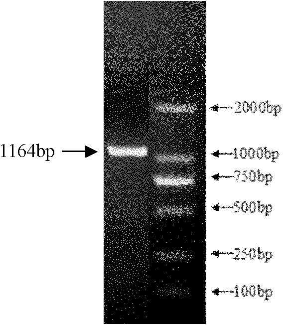 Riemerella anatipestifer-escherichia coli outer membrane protein bivalent vaccine and preparation method thereof