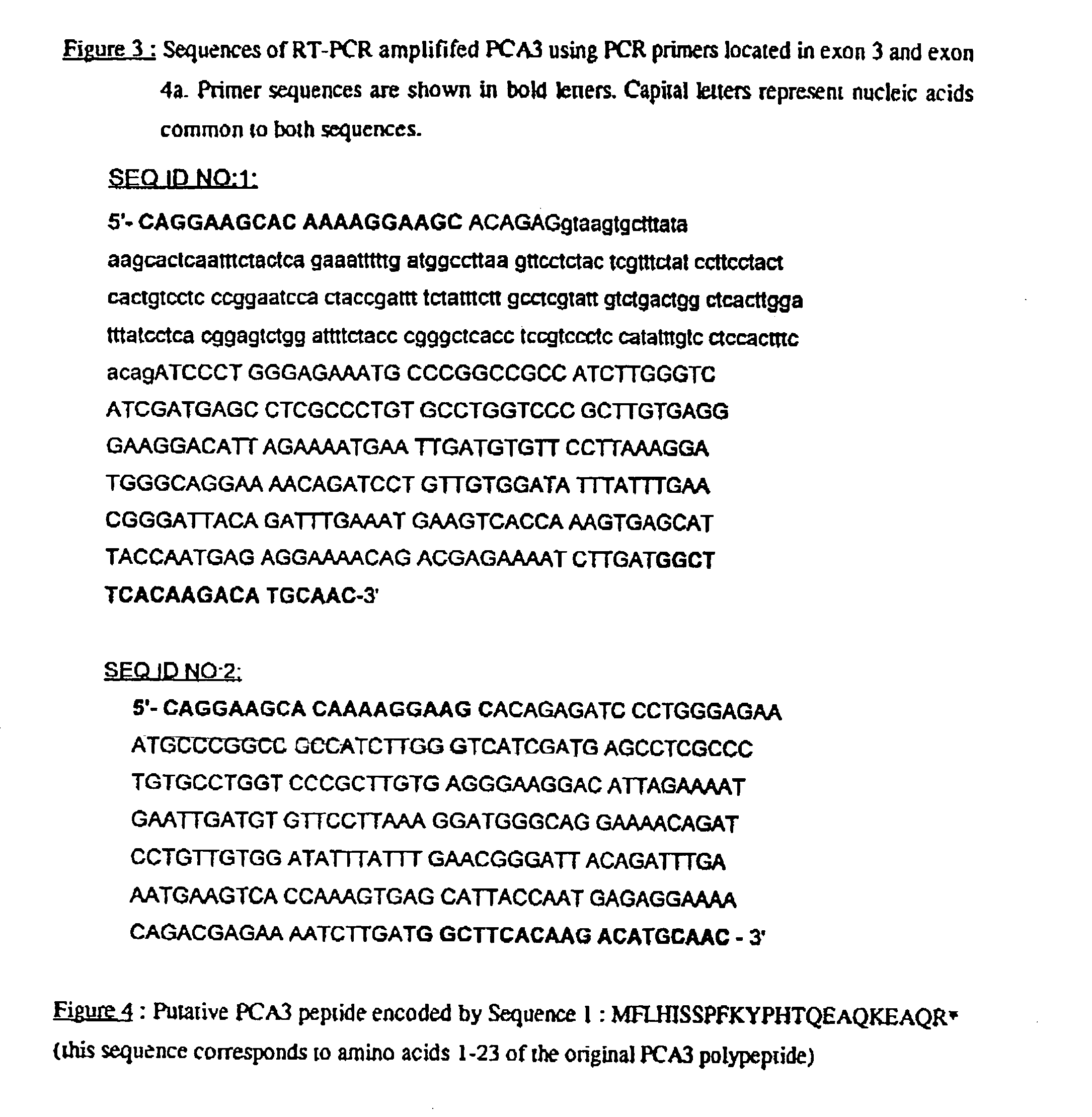 PCA3 messenger RNA species in benign and malignant prostate tissues