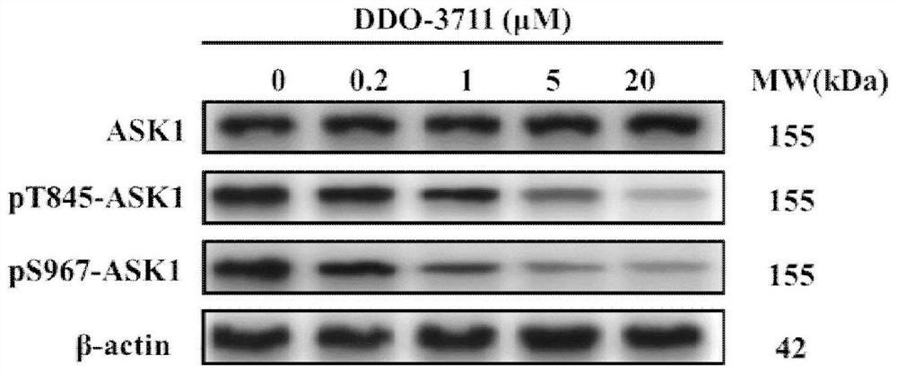 Protein phosphatase 5-based phosphatase recruitment chimera (PHORCs) compound as well as preparation method and medical application thereof