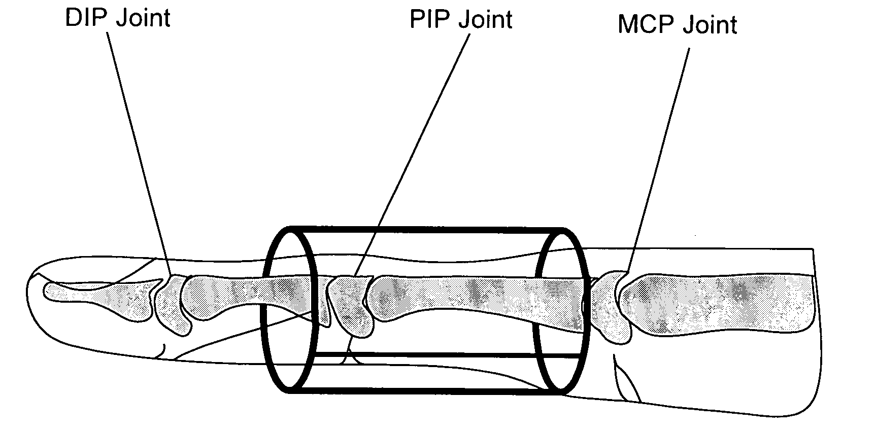 Adjustable, reusable, disposable finger splint to restrict flexion of the phalangeal joints of the hand