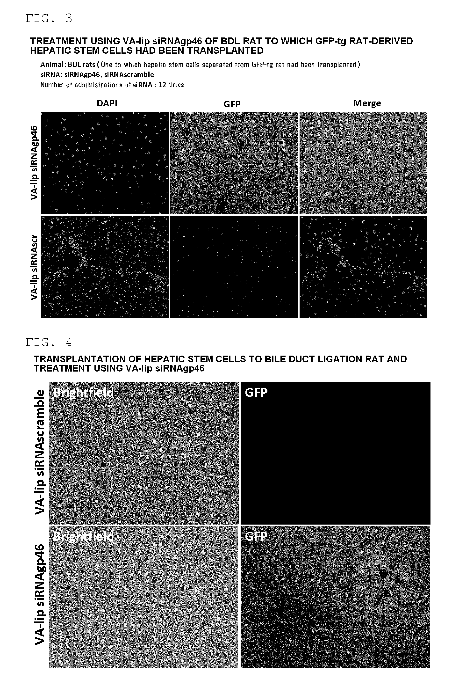 Composition for regenerating normal tissue from fibrotic tissue