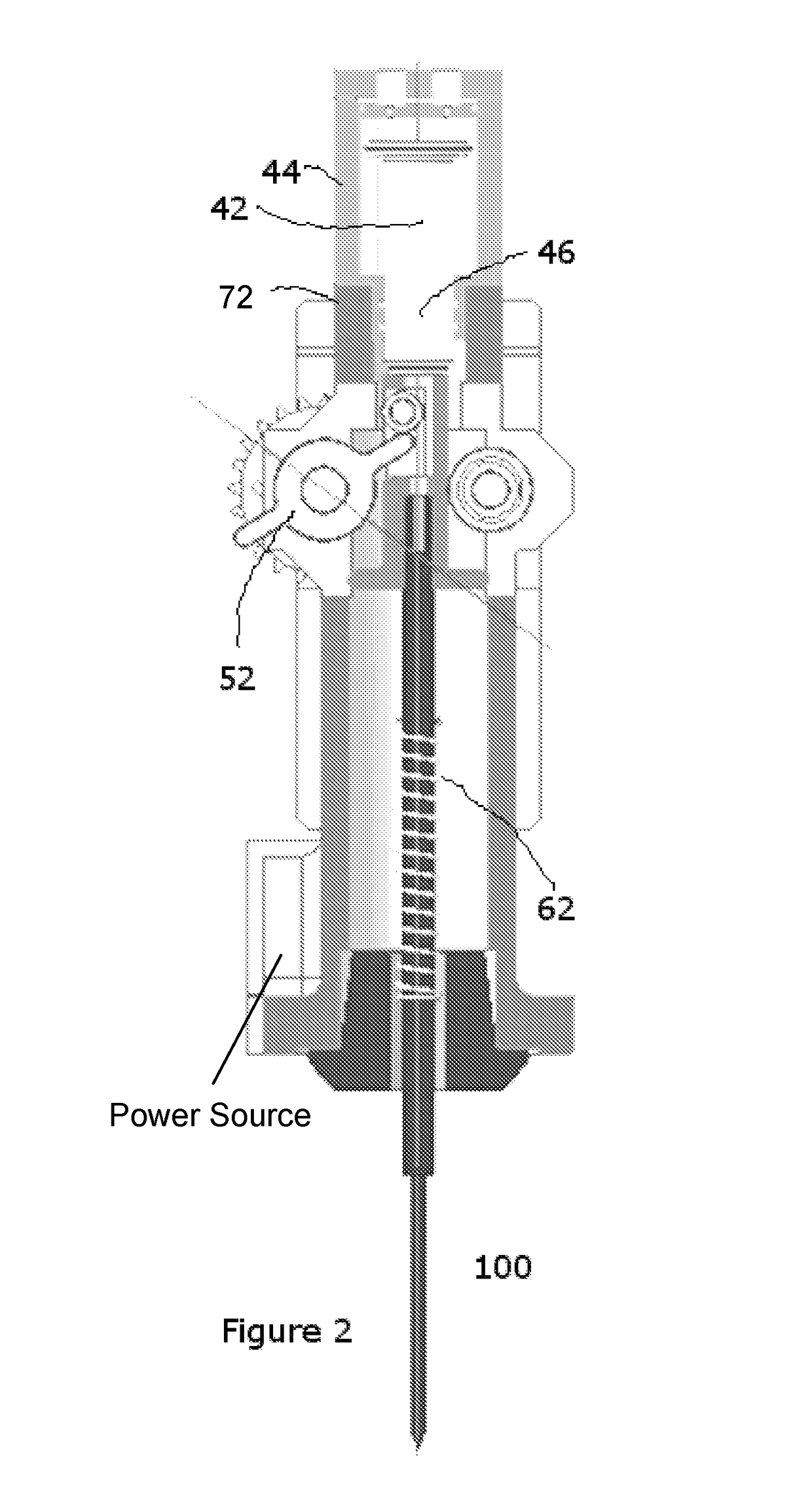 Fastener driving apparatus